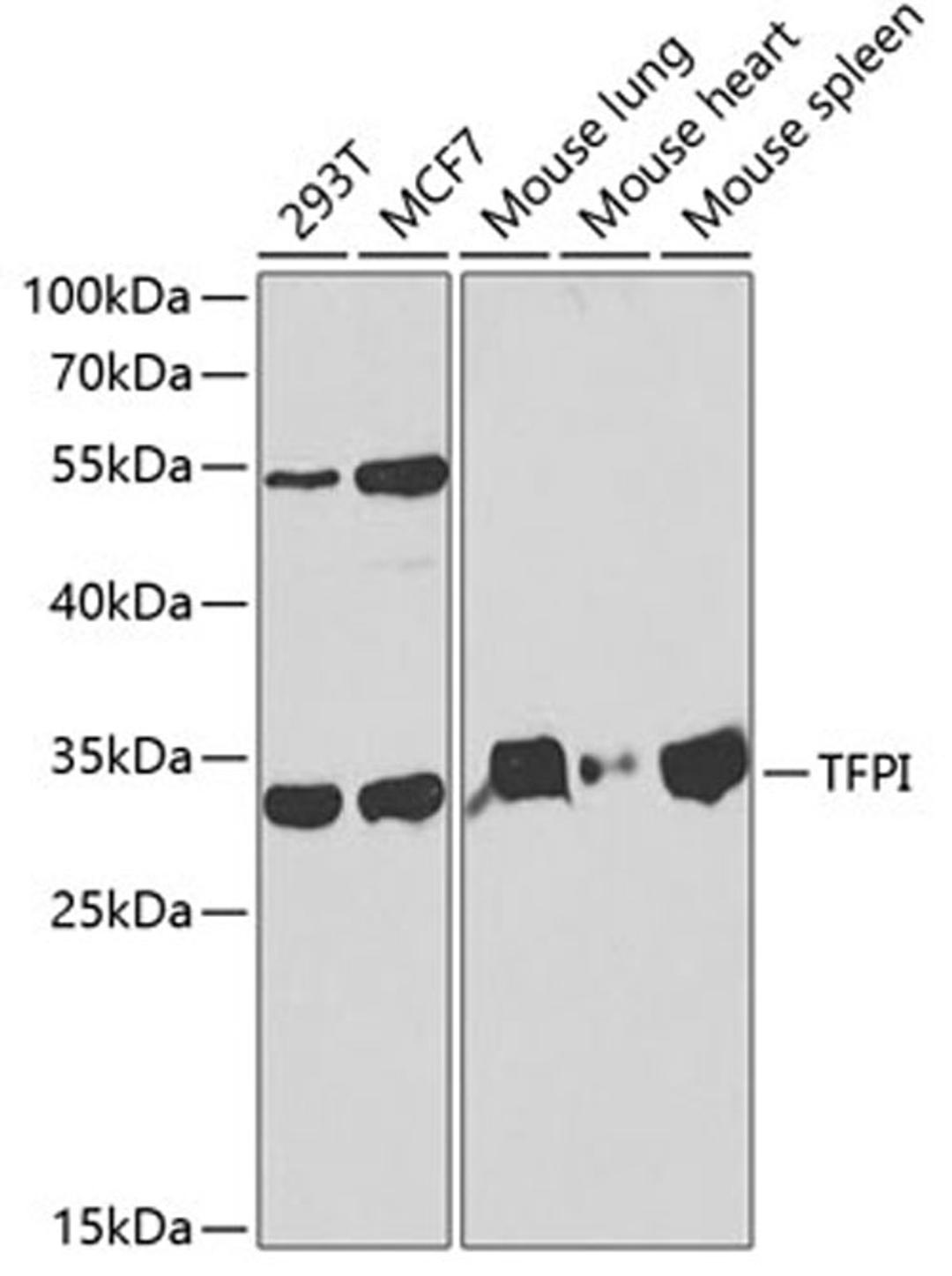 Western blot - TFPI antibody (A1624)