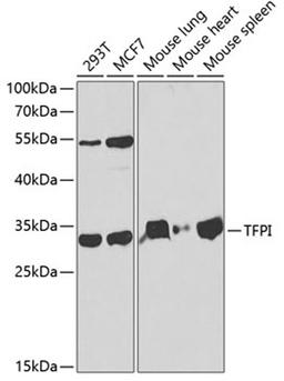 Western blot - TFPI antibody (A1624)