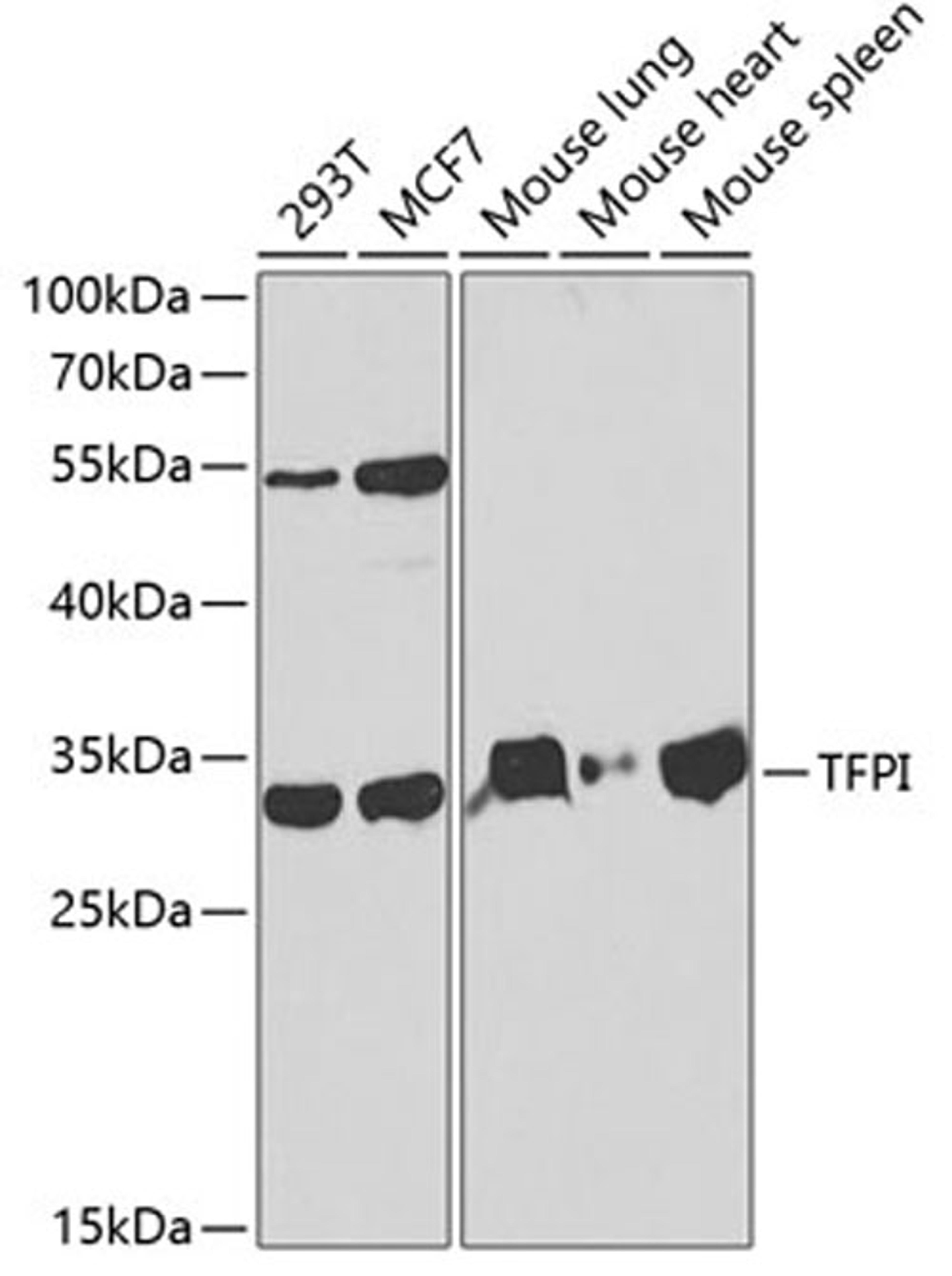 Western blot - TFPI antibody (A1624)