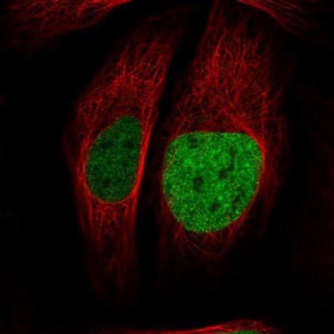 Immunocytochemistry/Immunofluorescence: ATAD2 Antibody [NBP1-84123] - Staining of human cell line U-2 OS shows positivity in nucleus but not nucleoli.