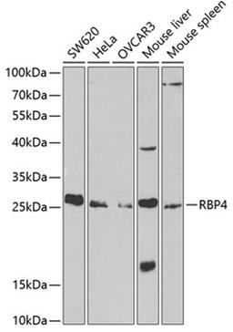 Western blot - RBP4 antibody (A1600)