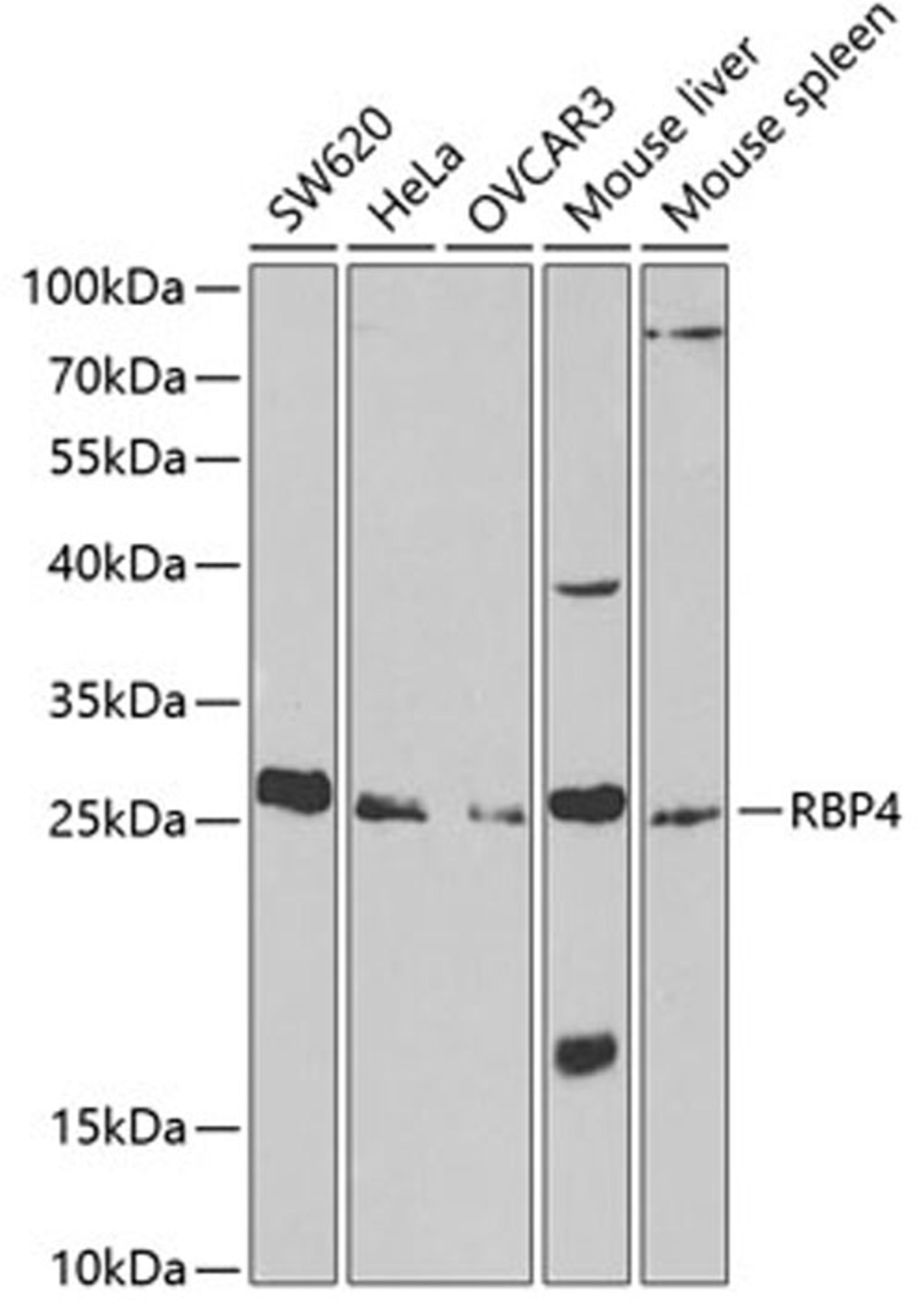 Western blot - RBP4 antibody (A1600)