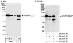 Detection of human HURP/DLG7 by western blot and immunoprecipitation.