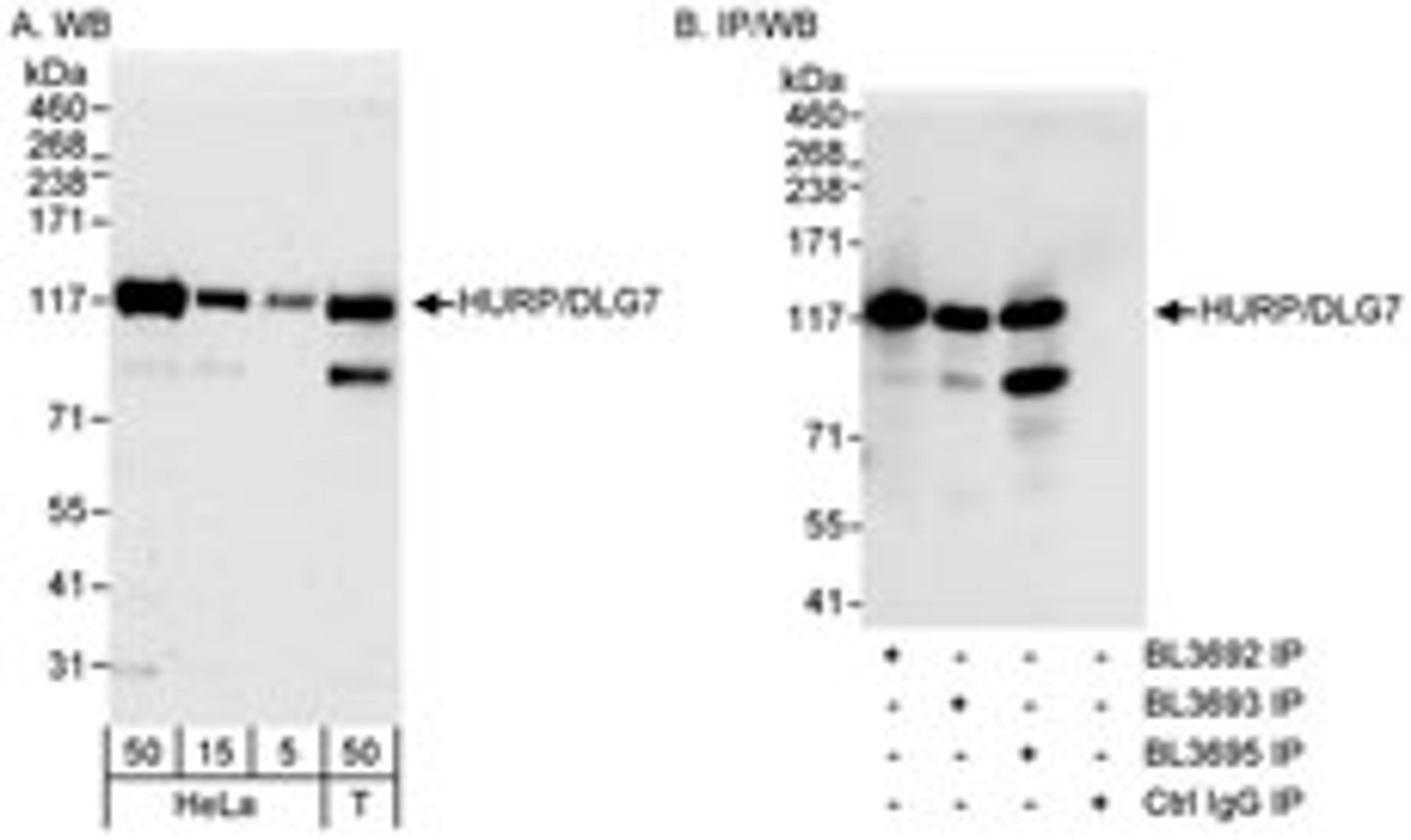 Detection of human HURP/DLG7 by western blot and immunoprecipitation.