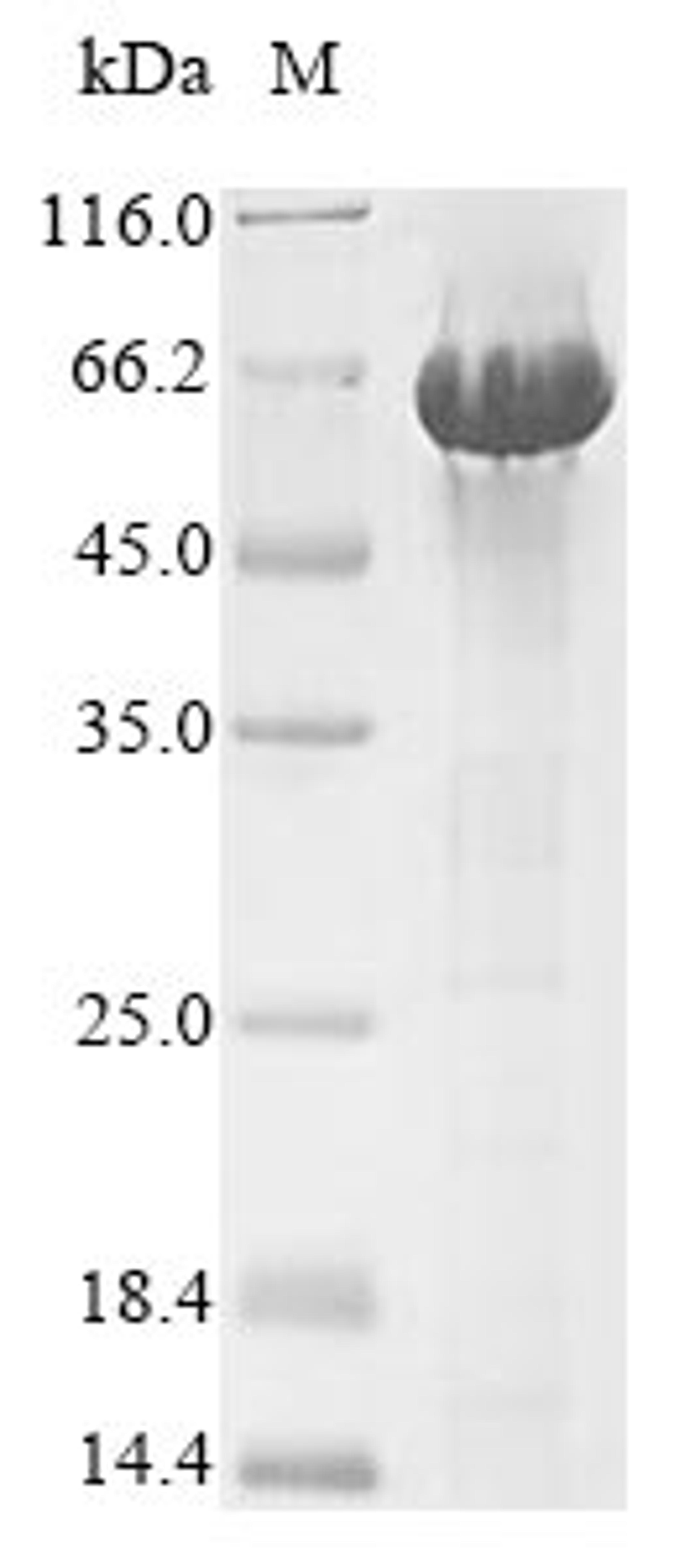(Tris-Glycine gel) Discontinuous SDS-PAGE (reduced) with 5% enrichment gel and 15% separation gel.