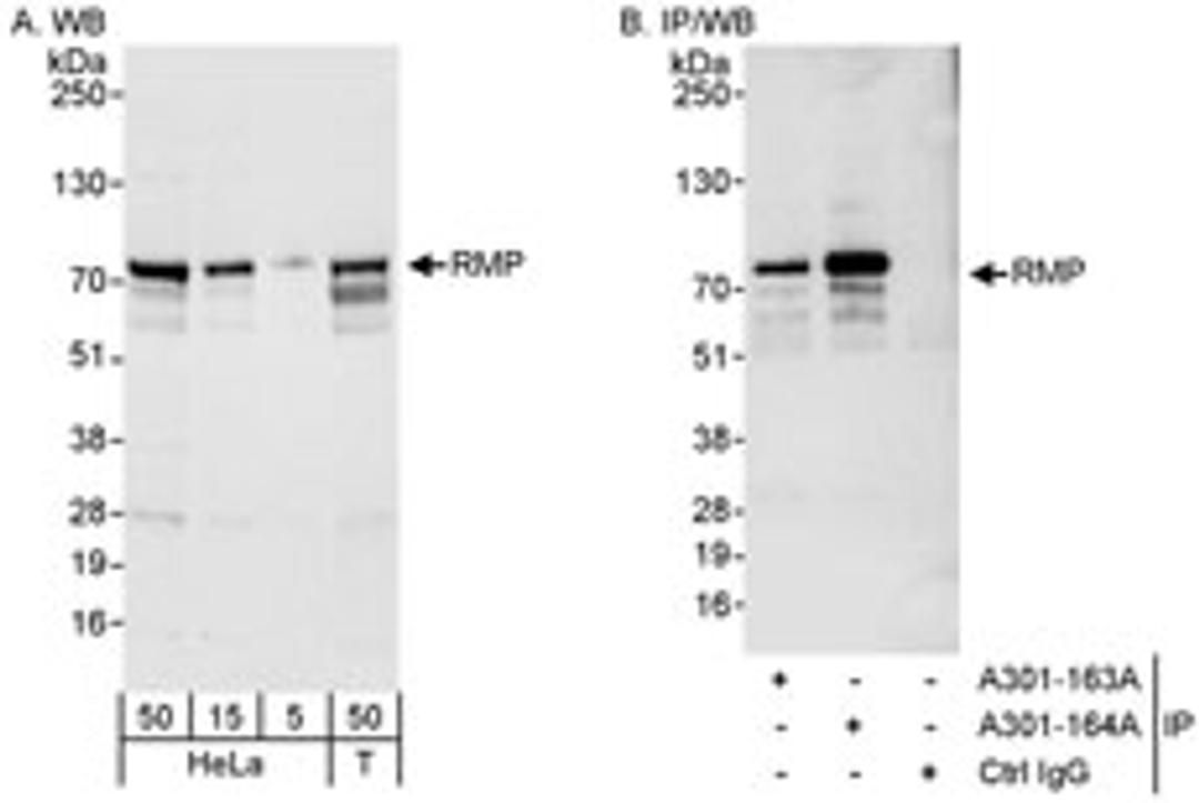 Detection of human RMP by western blot and immunoprecipitation.