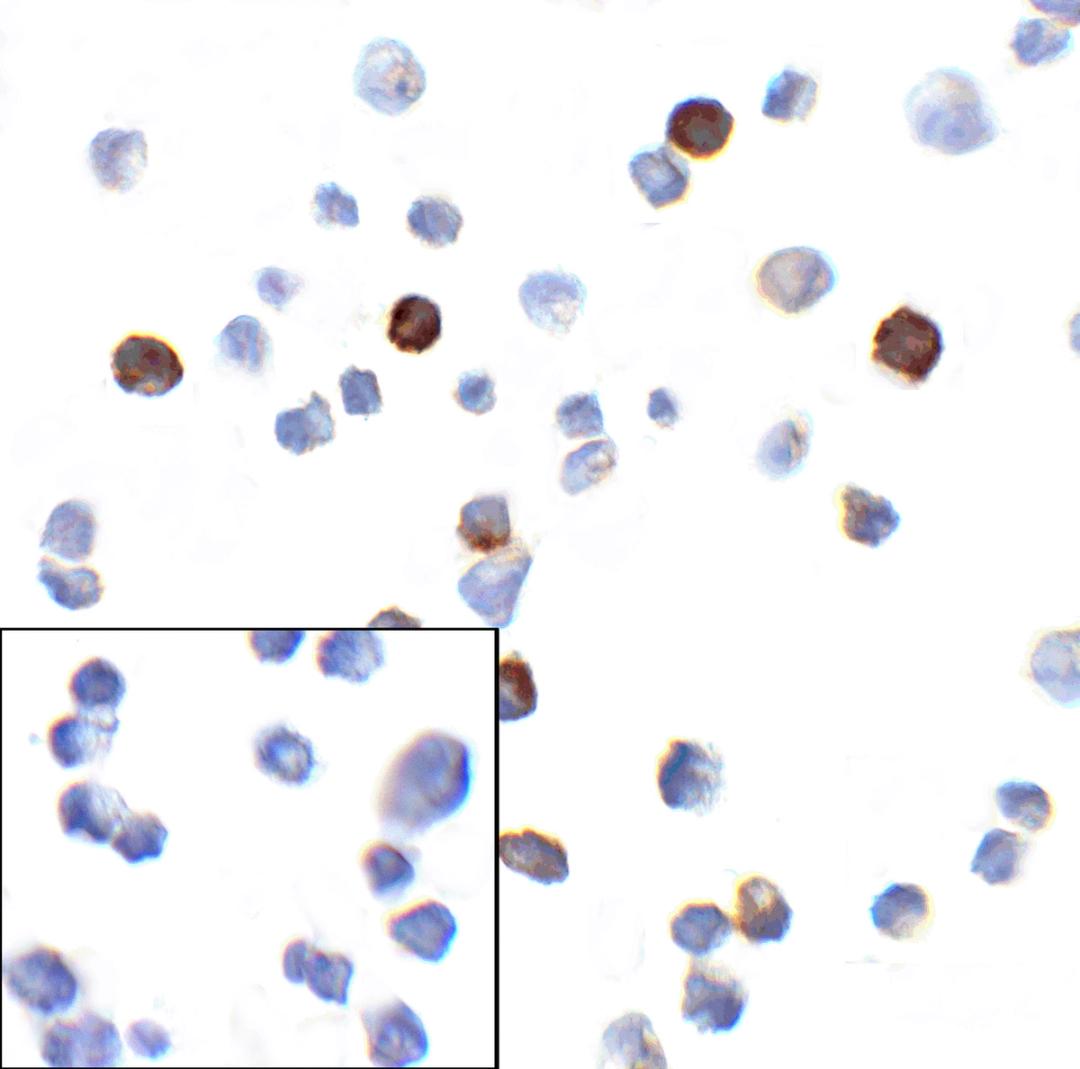 Immunocytochemistry of PD-1 in transfected 293 cells with PD-1 [4C7] antibody at 10 &#956;g/mL. Lower left: Immunocytochemistry in transfected 293 cells with control mouse IgG antibody at 10 &#956;g/mL.