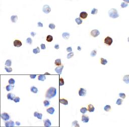 Immunocytochemistry of PD-1 in transfected 293 cells with PD-1 [4C7] antibody at 10 &#956;g/mL. Lower left: Immunocytochemistry in transfected 293 cells with control mouse IgG antibody at 10 &#956;g/mL.