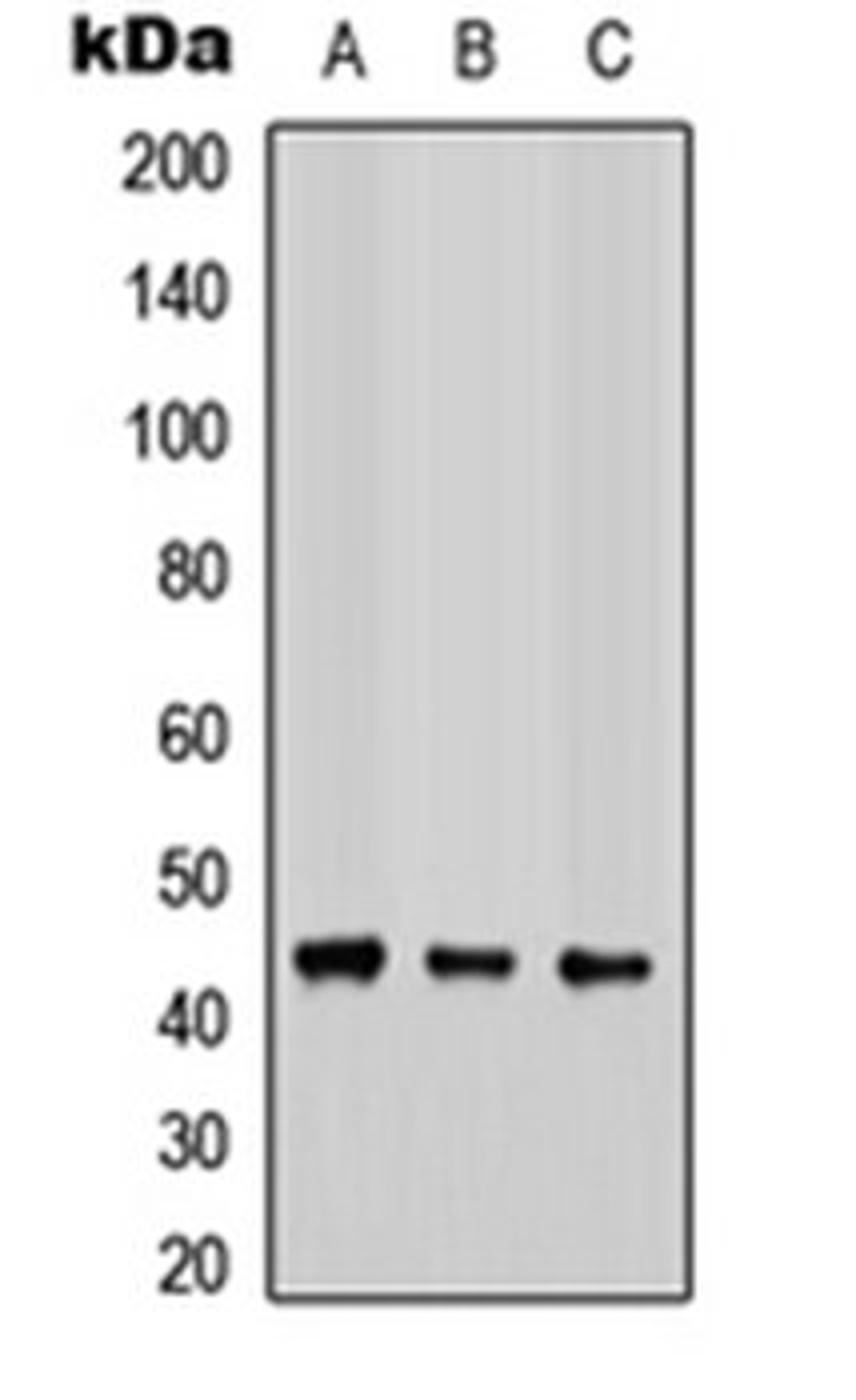 Western blot analysis of HEK293T (Lane 1), Raw264.7 (Lane 2), PC12 (Lane 3) whole cell lysates using COX15 antibody