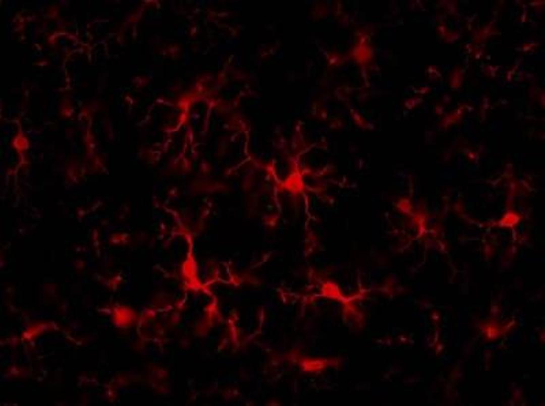 Immunocytochemistry: AIF-1/Iba1 Antibody [NB100-1028] - Analysis of Iba1 in rat brain and spinal cord. Image courtesy of anonymous customer product review.