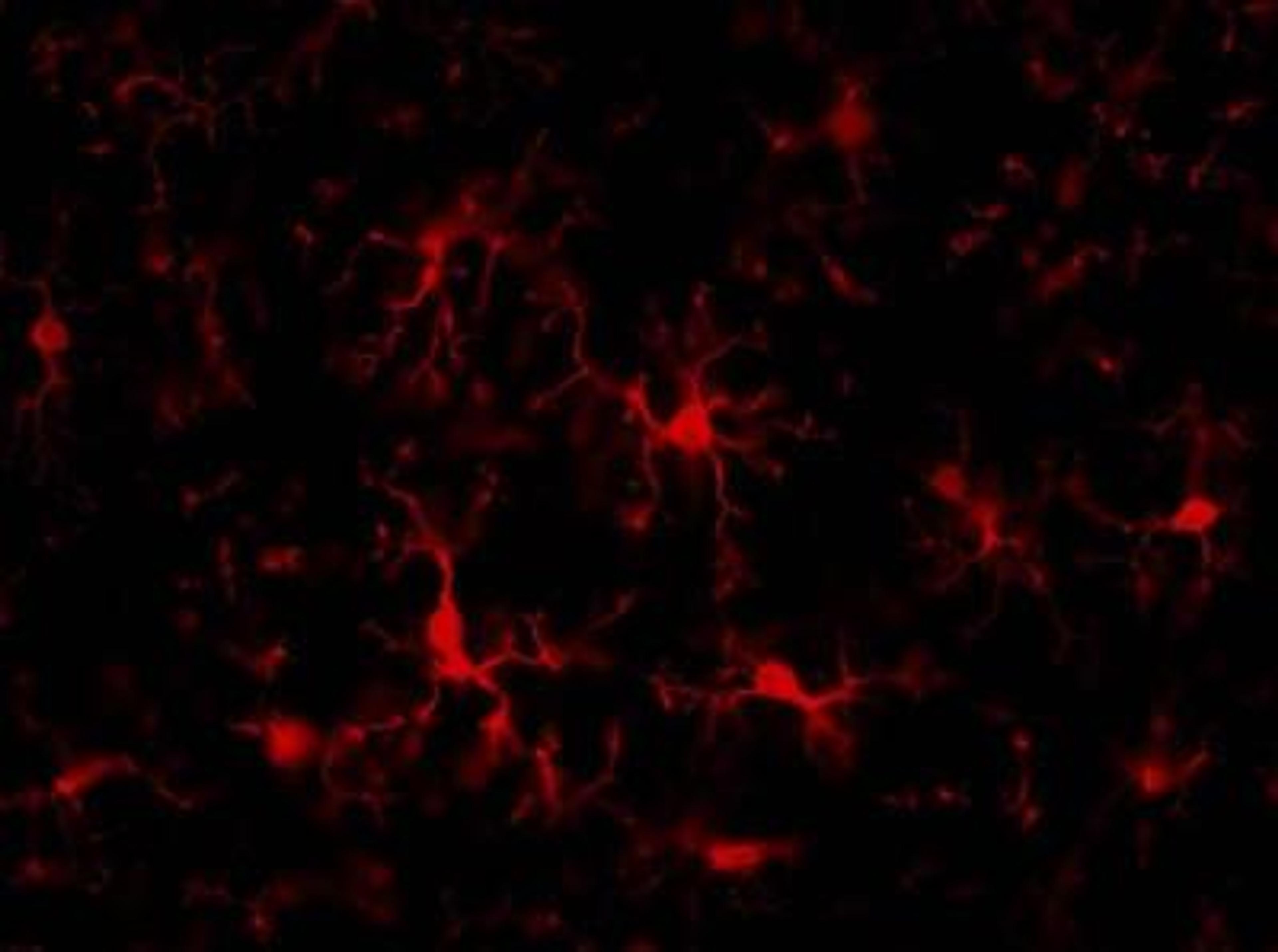 Immunocytochemistry: AIF-1/Iba1 Antibody [NB100-1028] - Analysis of Iba1 in rat brain and spinal cord. Image courtesy of anonymous customer product review.