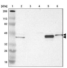 Western Blot: NDRG2 Antibody [NBP1-81424] - Lane 1: Marker [kDa] 206, 113, 82, 49, 32, 26, 18<br/>Lane 2: Human cell line RT-4<br/>Lane 3: Human cell line U-251MG sp<br/>Lane 4: Human cell line A-431<br/>Lane 5: Human liver tissue<br/>Lane 6: Human tonsil tissue