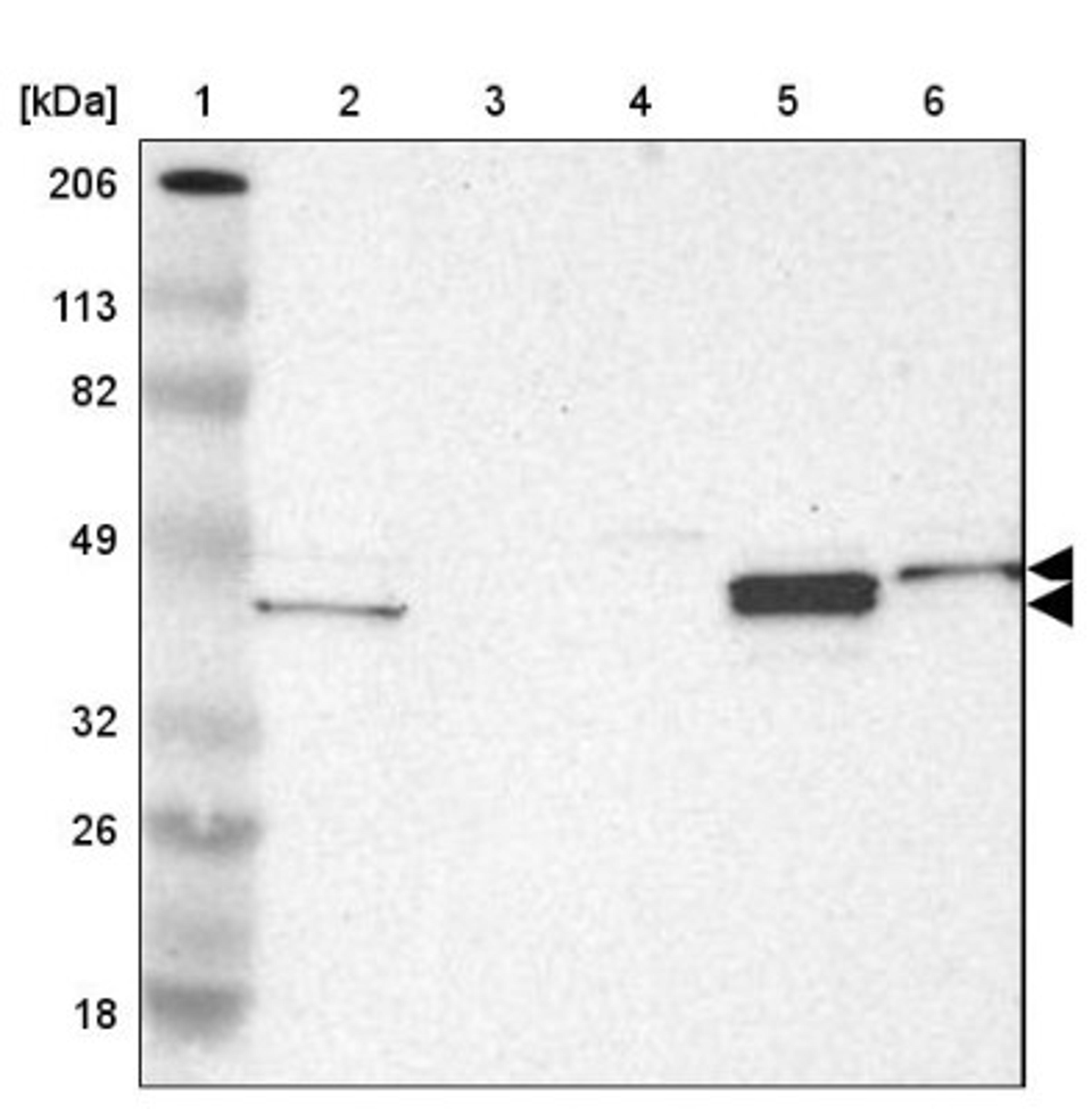 Western Blot: NDRG2 Antibody [NBP1-81424] - Lane 1: Marker [kDa] 206, 113, 82, 49, 32, 26, 18<br/>Lane 2: Human cell line RT-4<br/>Lane 3: Human cell line U-251MG sp<br/>Lane 4: Human cell line A-431<br/>Lane 5: Human liver tissue<br/>Lane 6: Human tonsil tissue