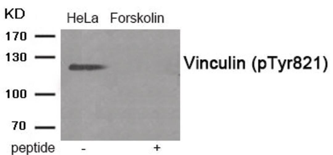 Western blot analysis of extracts from HeLa cells treated with Forskolin using Phospho-Vinculin (Tyr821) Antibody. The lane on the right is treated with the antigen-specific peptide.