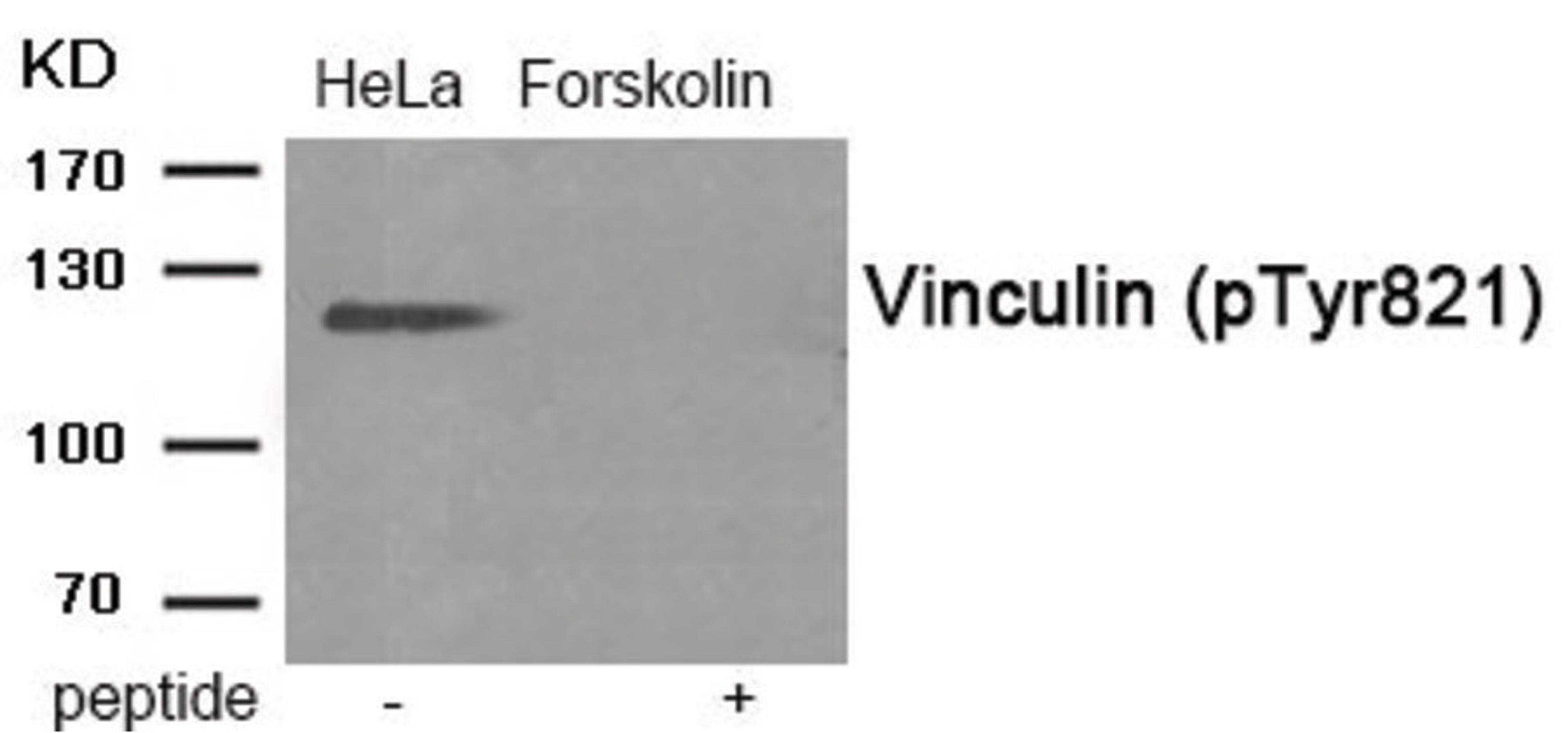 Western blot analysis of extracts from HeLa cells treated with Forskolin using Phospho-Vinculin (Tyr821) Antibody. The lane on the right is treated with the antigen-specific peptide.