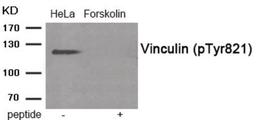 Western blot analysis of extracts from HeLa cells treated with Forskolin using Phospho-Vinculin (Tyr821) Antibody. The lane on the right is treated with the antigen-specific peptide.
