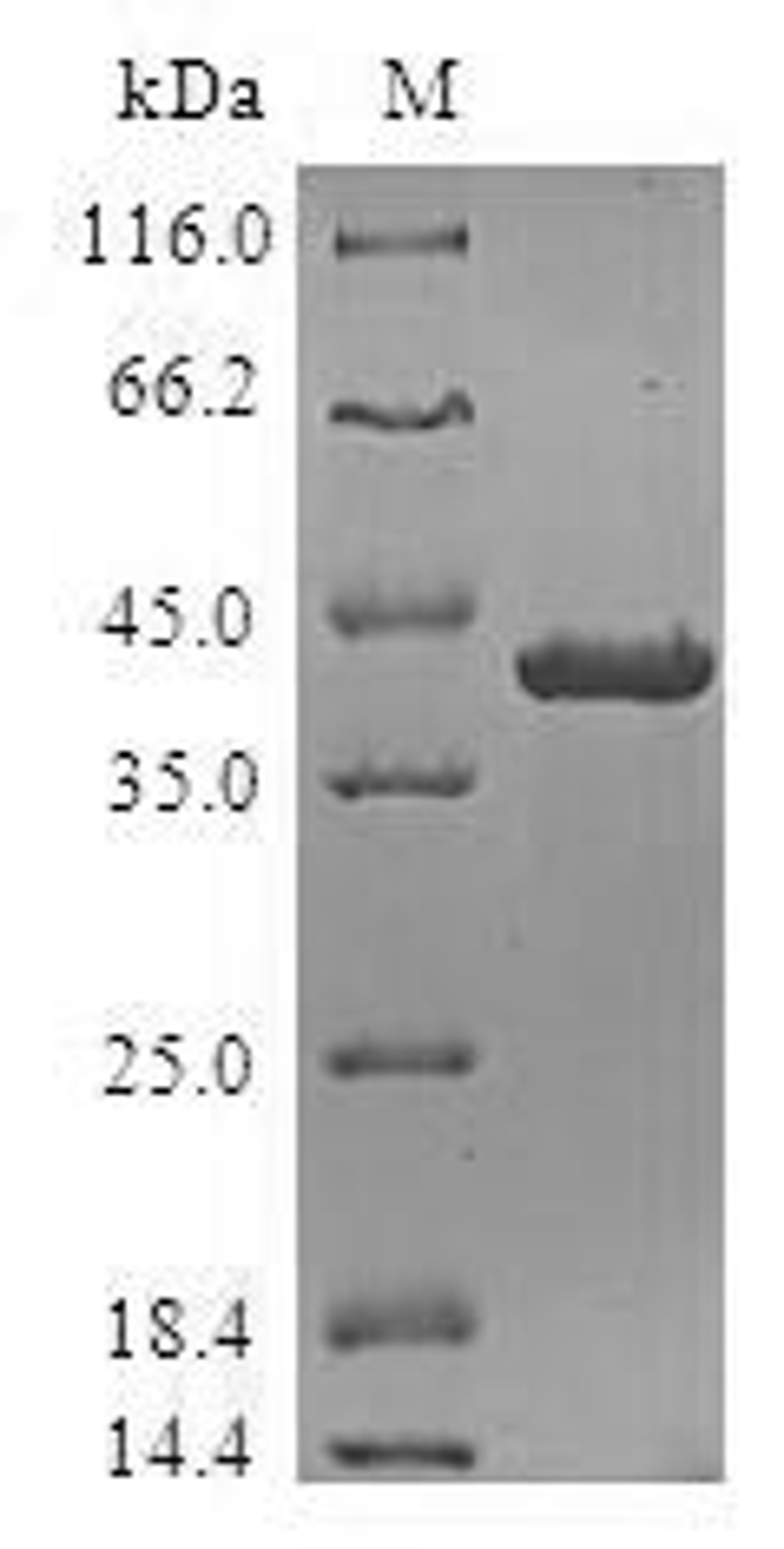 (Tris-Glycine gel) Discontinuous SDS-PAGE (reduced) with 5% enrichment gel and 15% separation gel.