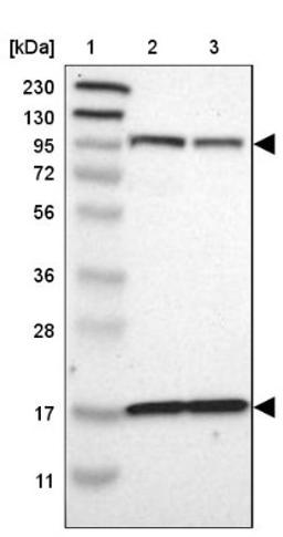 Western Blot: DPP8 Antibody [NBP1-84993] - Lane 1: Marker [kDa] 230, 130, 95, 72, 56, 36, 28, 17, 11<br/>Lane 2: Human cell line RT-4<br/>Lane 3: Human cell line U-251MG sp