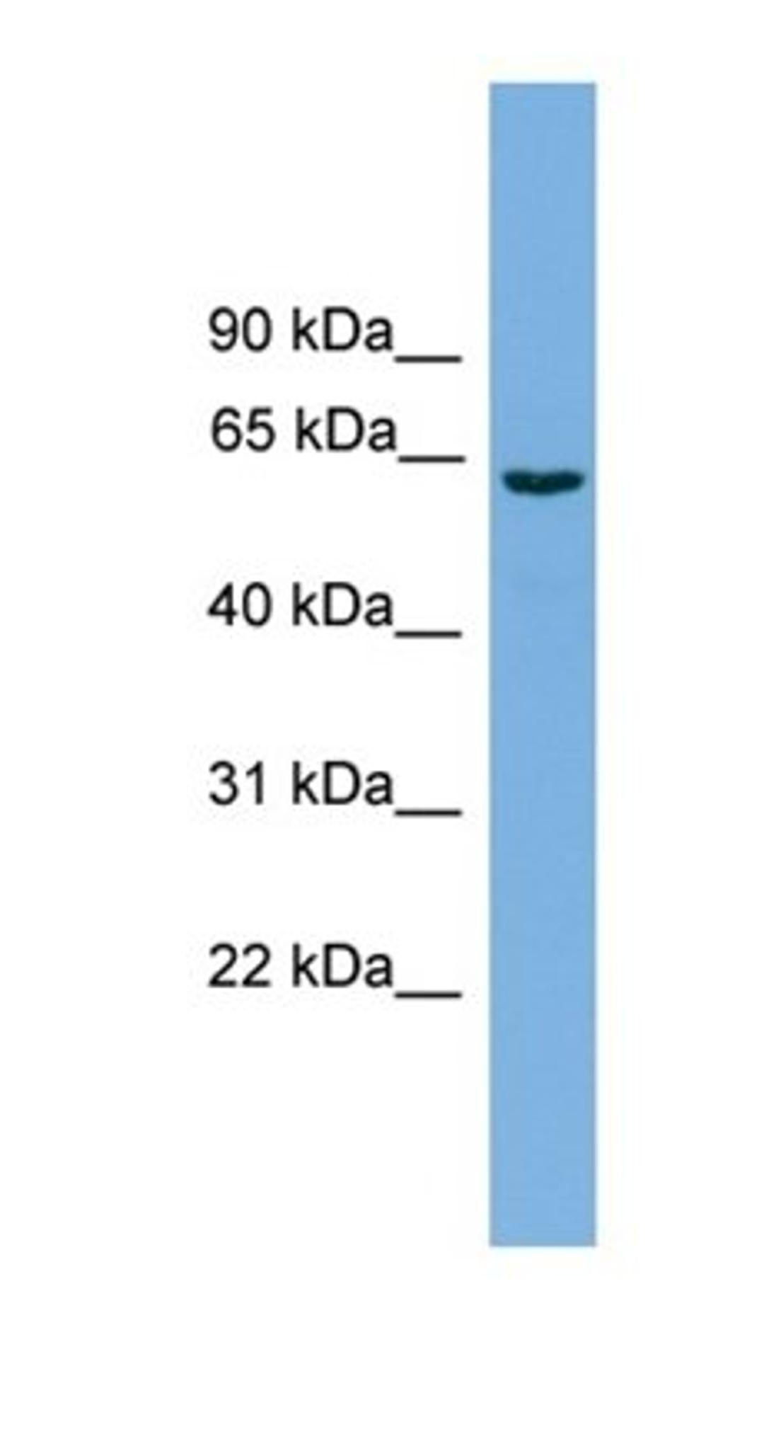 Western blot analysis of PANC1 cell lysate tissue using SLCO1A2 antibody