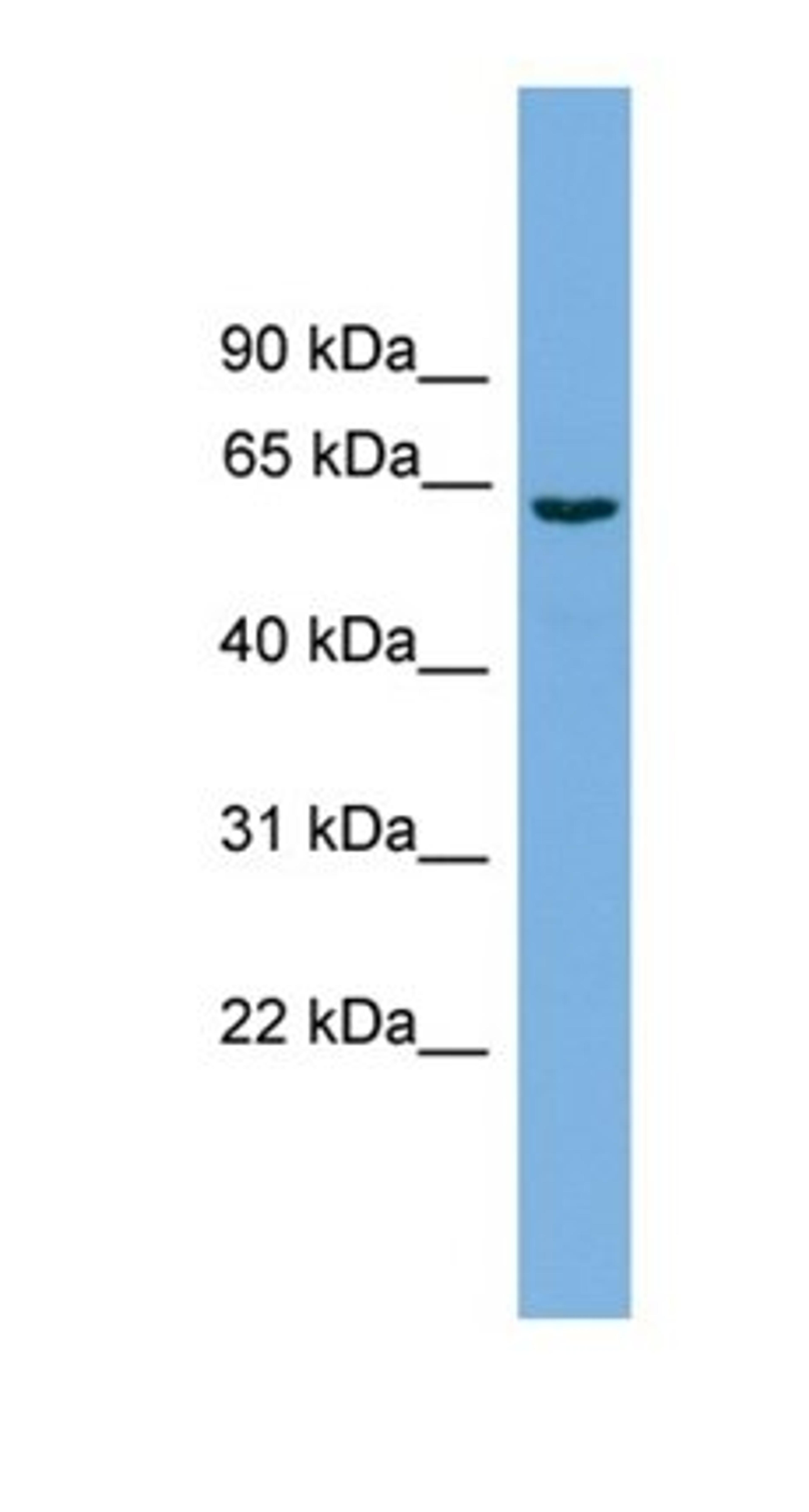 Western blot analysis of PANC1 cell lysate tissue using SLCO1A2 antibody