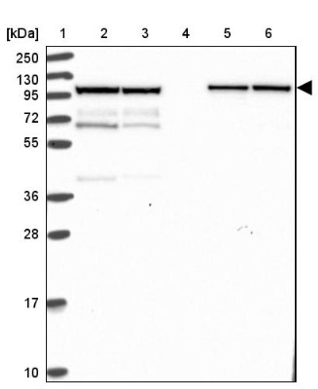 Western Blot: KLC1 Antibody [NBP2-33649] - Lane 1: Marker [kDa] 250, 130, 95, 72, 55, 36, 28, 17, 10<br/>Lane 2: Human cell line RT-4<br/>Lane 3: Human cell line U-251MG sp<br/>Lane 4: Human plasma (IgG/HSA depleted)<br/>Lane 5: Human liver tissue<br/>Lane 6: Human tonsil tissue