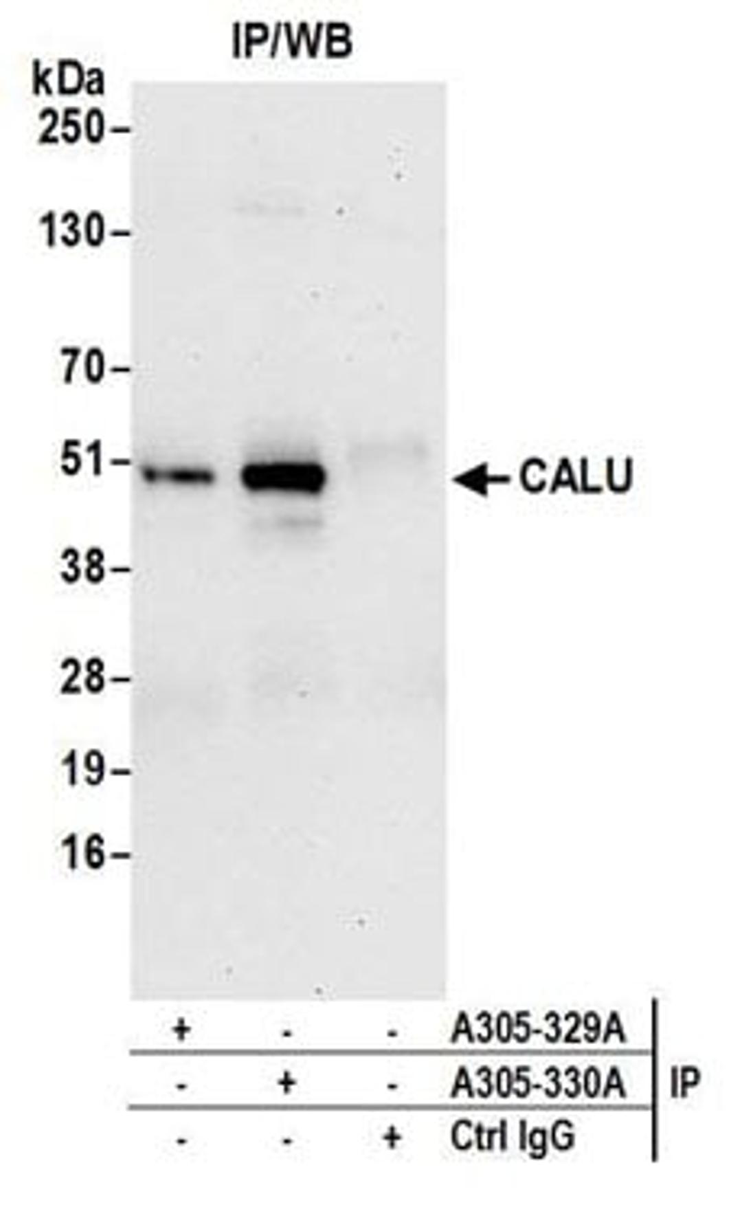 Detection of human CALU by western blot of immunoprecipitates.