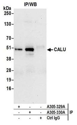 Detection of human CALU by western blot of immunoprecipitates.