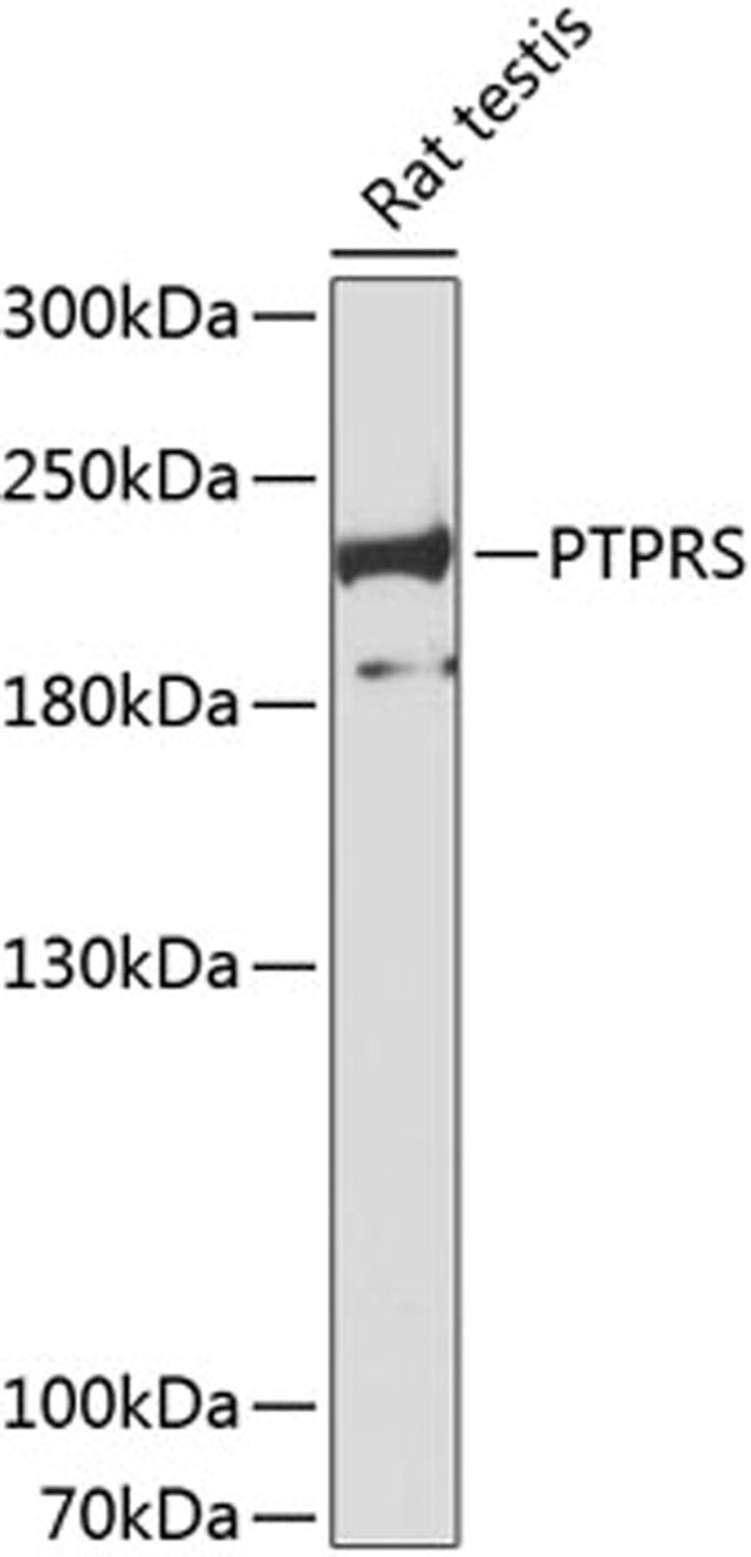 Western blot - PTPRS antibody (A8866)