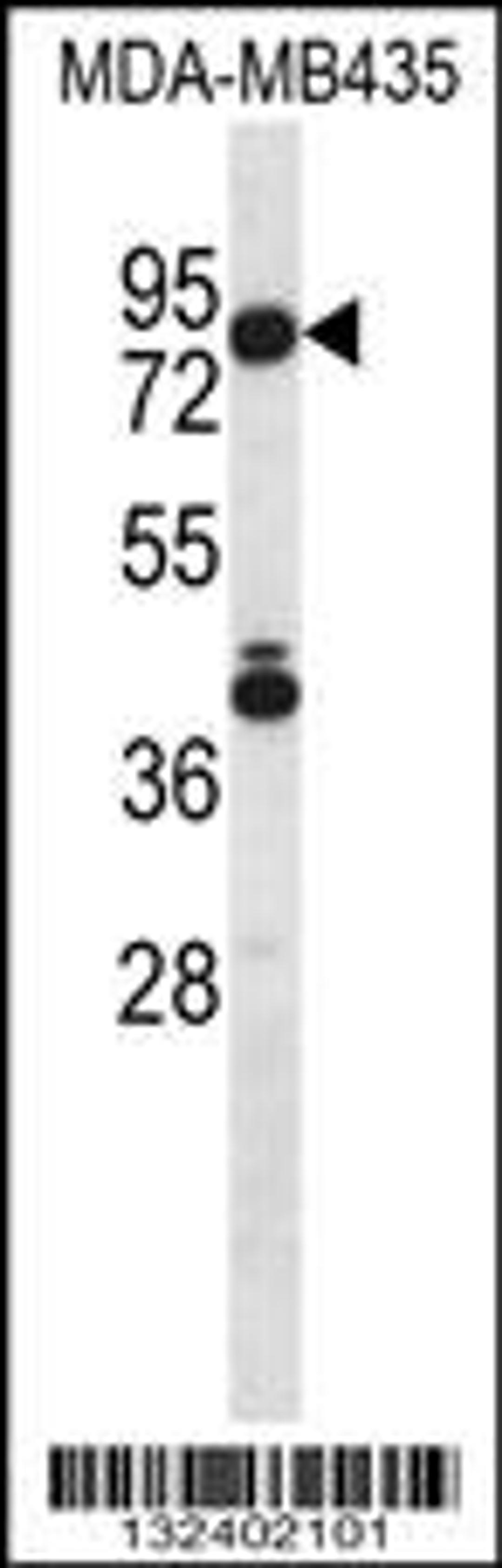 Western blot analysis in MDA-MB435 cell line lysates (35ug/lane).