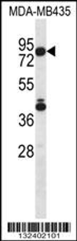 Western blot analysis in MDA-MB435 cell line lysates (35ug/lane).