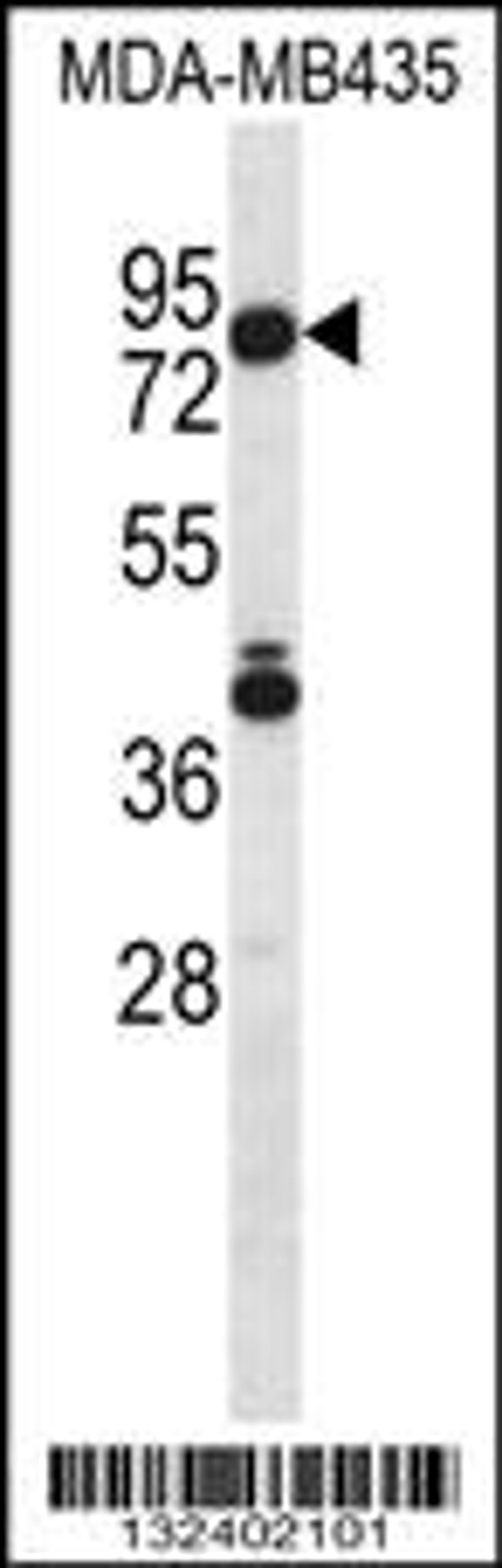 Western blot analysis in MDA-MB435 cell line lysates (35ug/lane).