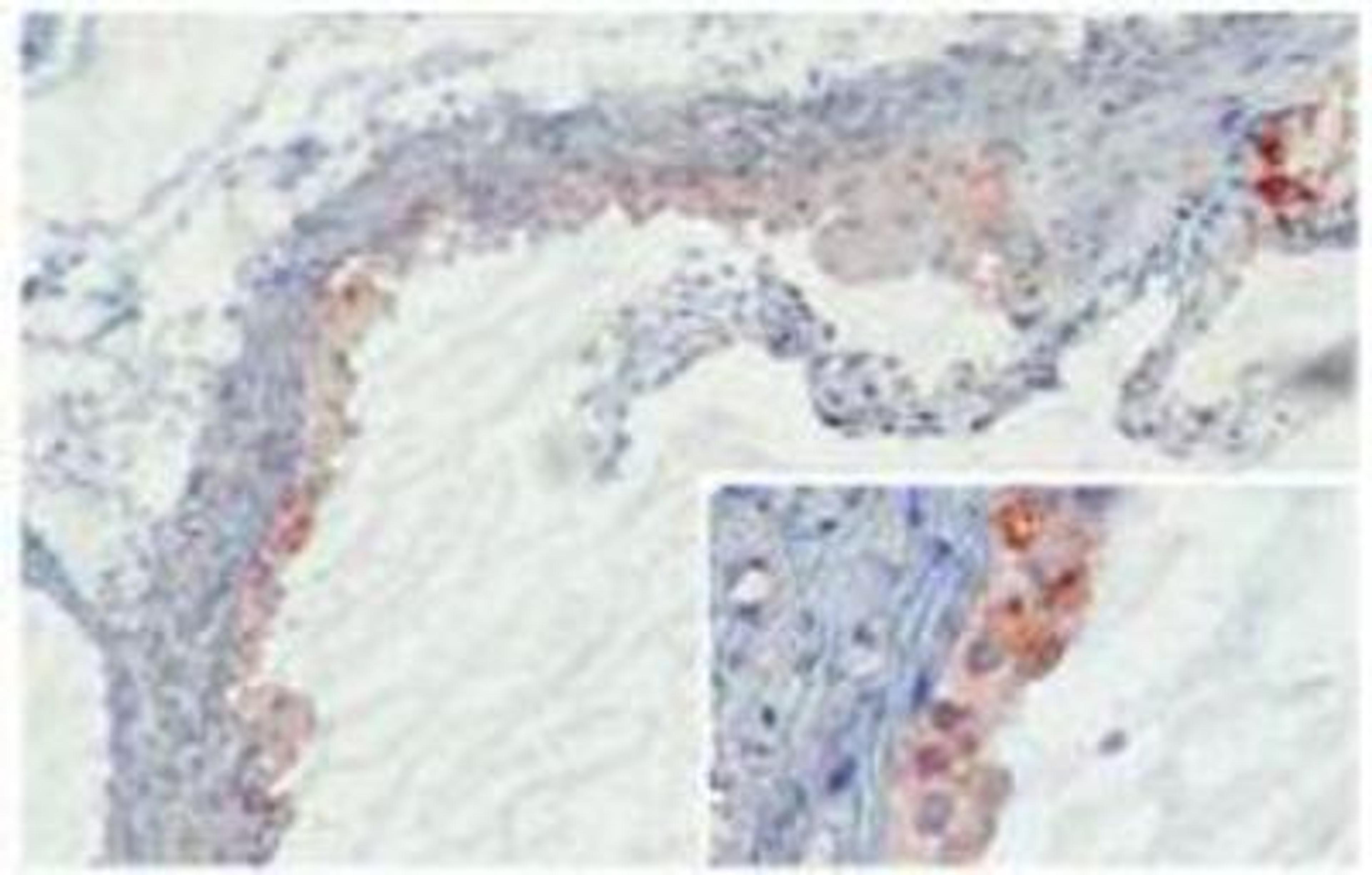 Immunohistochemistry-Frozen: Antibody (mAb 14D12) - MBL-C (clone 14D12) deposition in developing murine atherosclerotic lesions following 10 weeks of high fat feeding. MBL-C was detected in and around invading macrophages invading the intima (insert). MBL-C bound, similar to MBL-A, at sites of necrosis (upper right corner). No MBL-C binding was shown in the media or on fibrous caps covering the thickened intima.