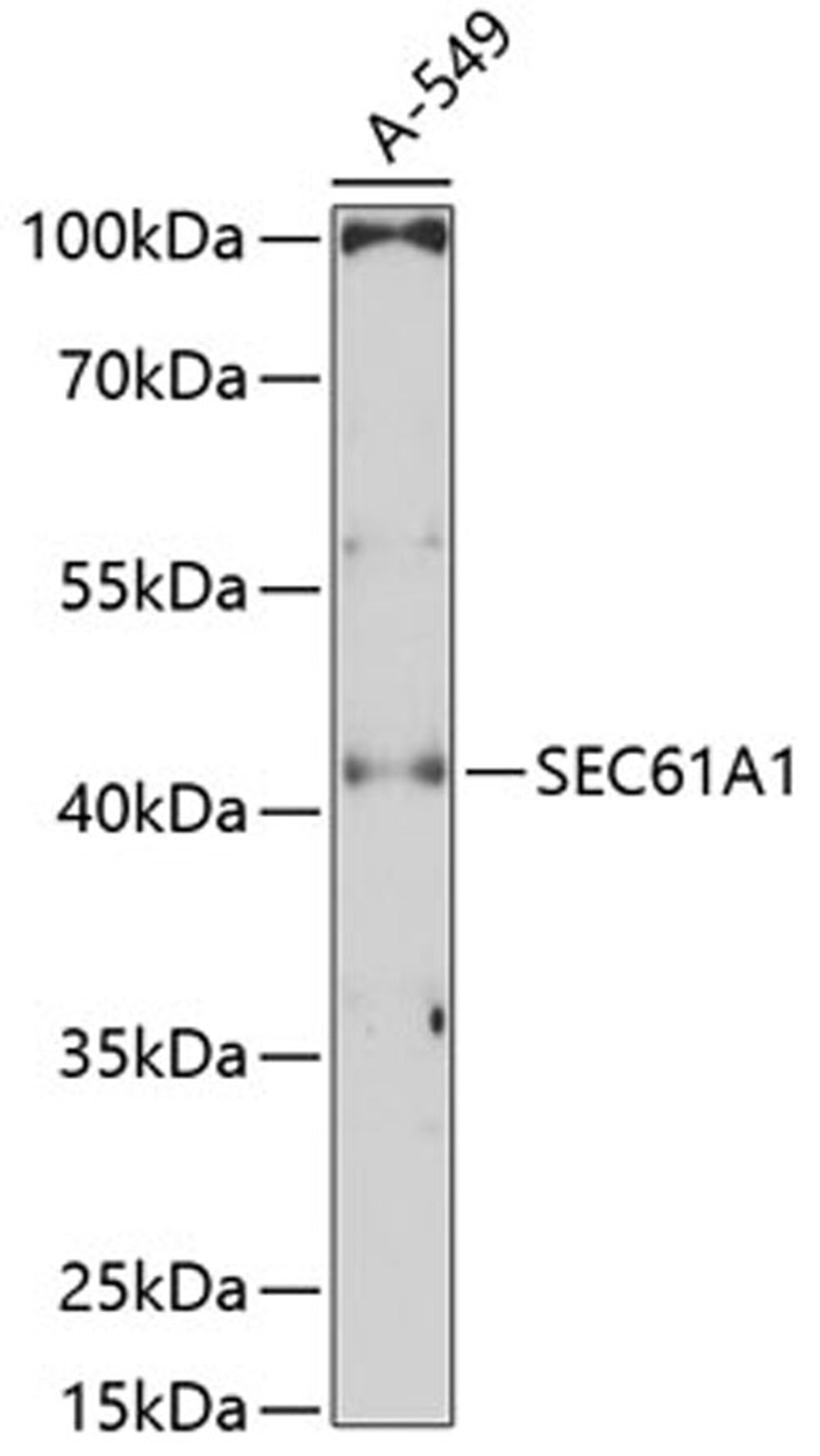 Western blot - SEC61A1 Antibody (A11614)