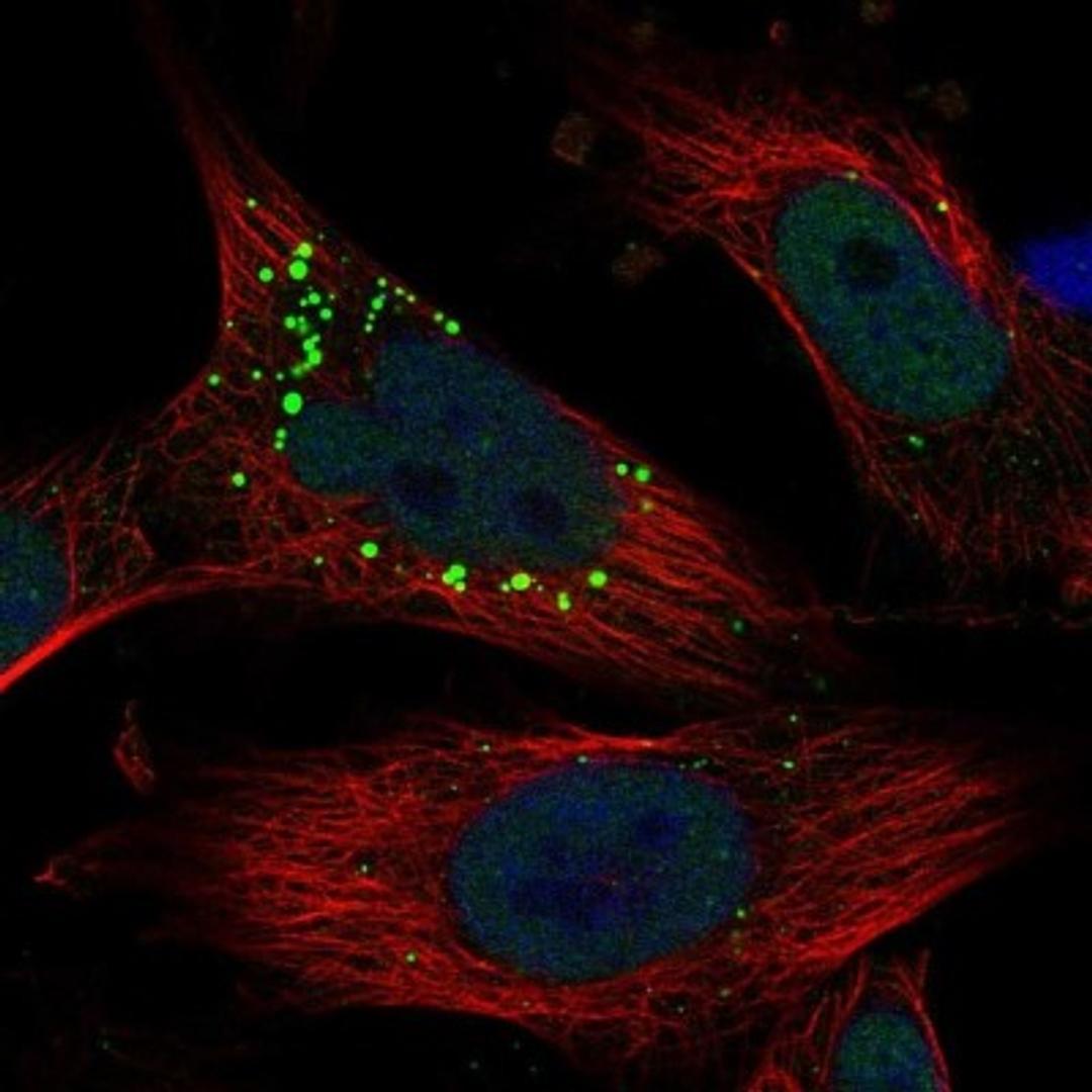 Immunocytochemistry/Immunofluorescence: TUG Antibody [NBP1-90079] - Staining of human cell line U-251MG shows positivity in nucleus but not nucleoli & vesicles.