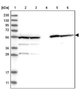 Western Blot: Aldehyde dehydrogenase 5 Antibody [NBP1-90192] - Lane 1: Marker [kDa] 230, 130, 95, 72, 56, 36, 28, 17, 11<br/>Lane 2: Human cell line RT-4<br/>Lane 3: Human cell line U-251MG sp<br/>Lane 4: Human plasma (IgG/HSA depleted)<br/>Lane 5: Human liver tissue<br/>Lane 6: Human tonsil tissue