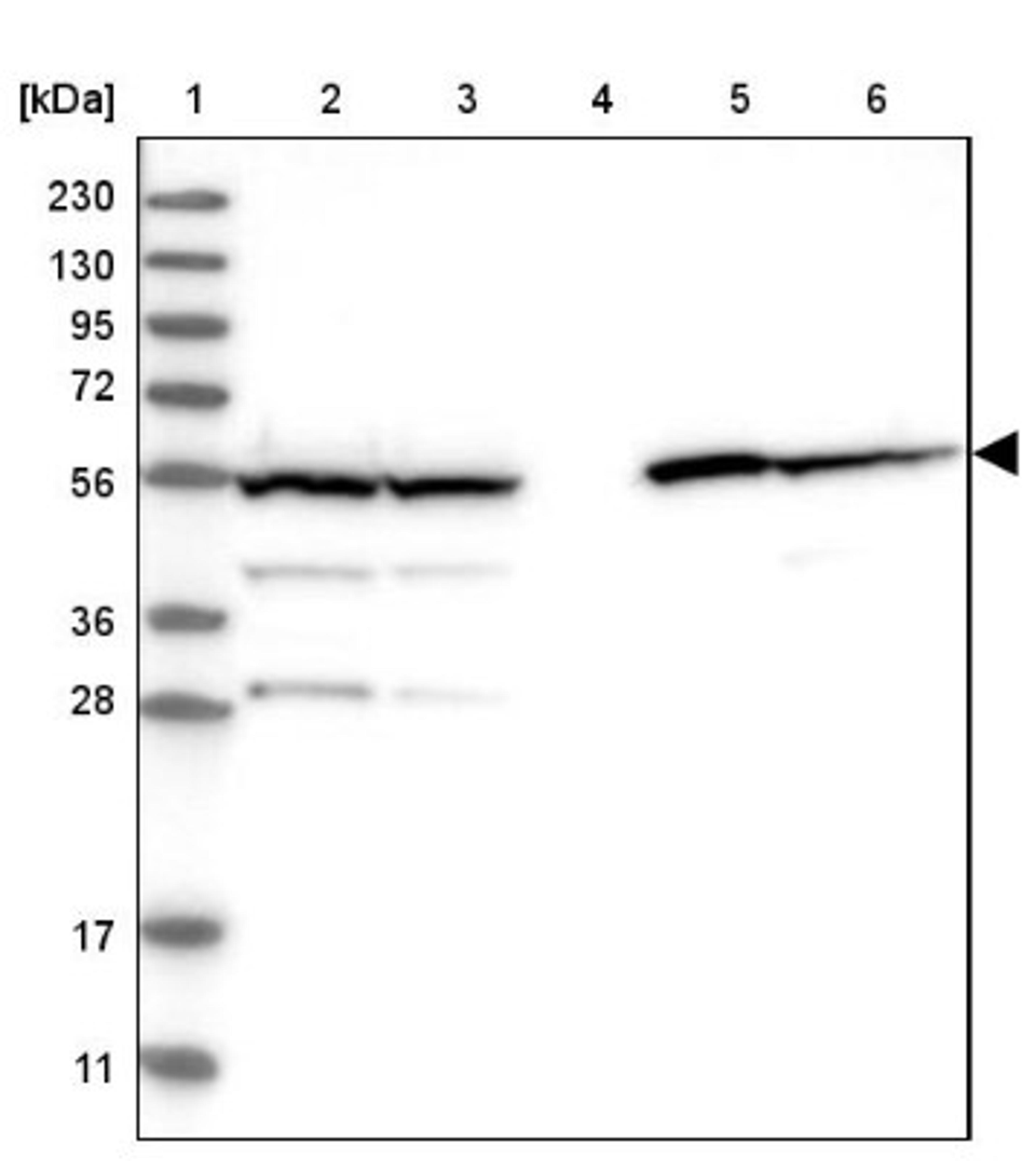 Western Blot: Aldehyde dehydrogenase 5 Antibody [NBP1-90192] - Lane 1: Marker [kDa] 230, 130, 95, 72, 56, 36, 28, 17, 11<br/>Lane 2: Human cell line RT-4<br/>Lane 3: Human cell line U-251MG sp<br/>Lane 4: Human plasma (IgG/HSA depleted)<br/>Lane 5: Human liver tissue<br/>Lane 6: Human tonsil tissue