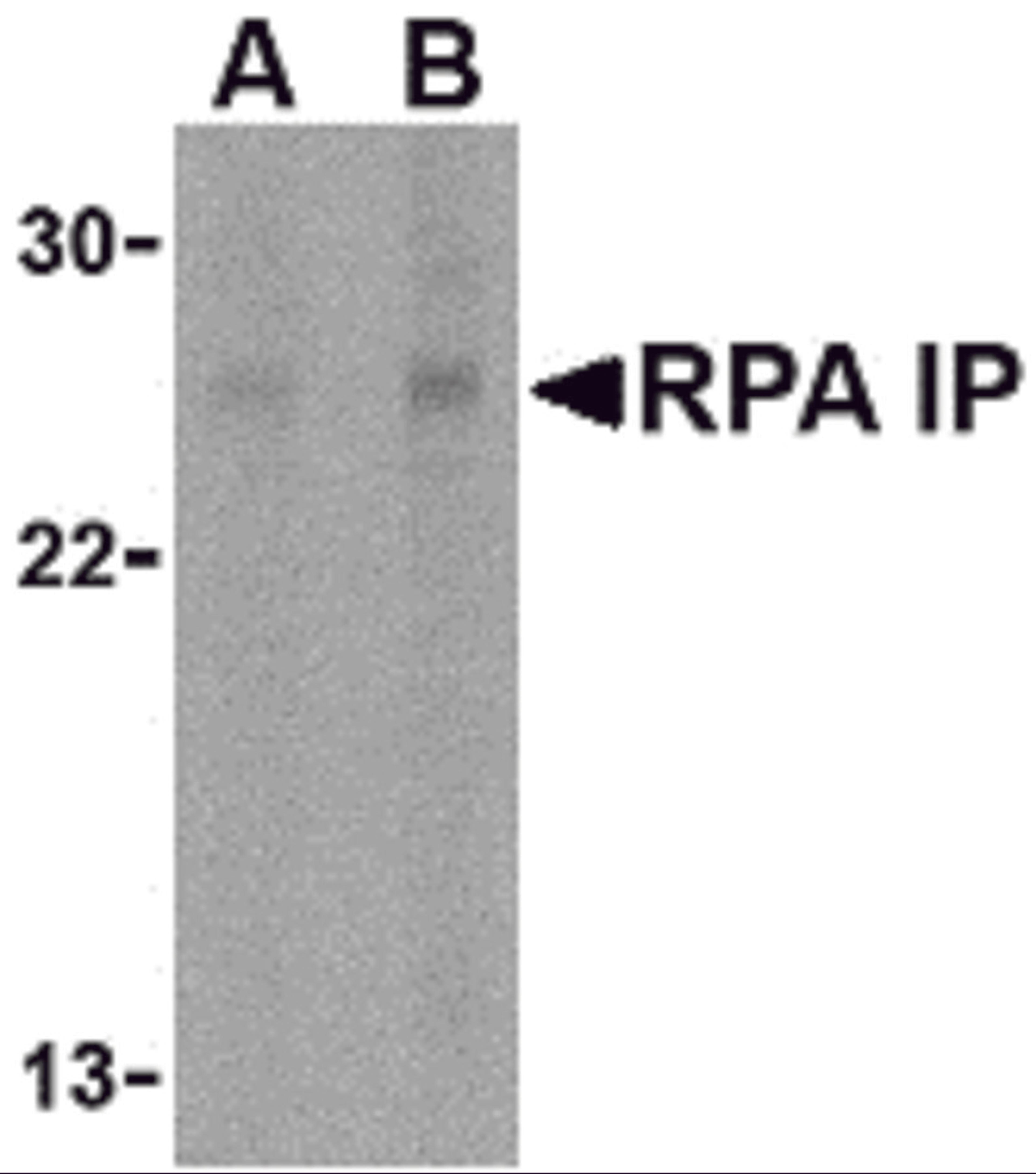 Western blot analysis of RPA Interacting Protein in Jurkat cell lysate with RPA Interacting Protein antibody at (A) 1 and (B) 2 &#956;g/mL. 