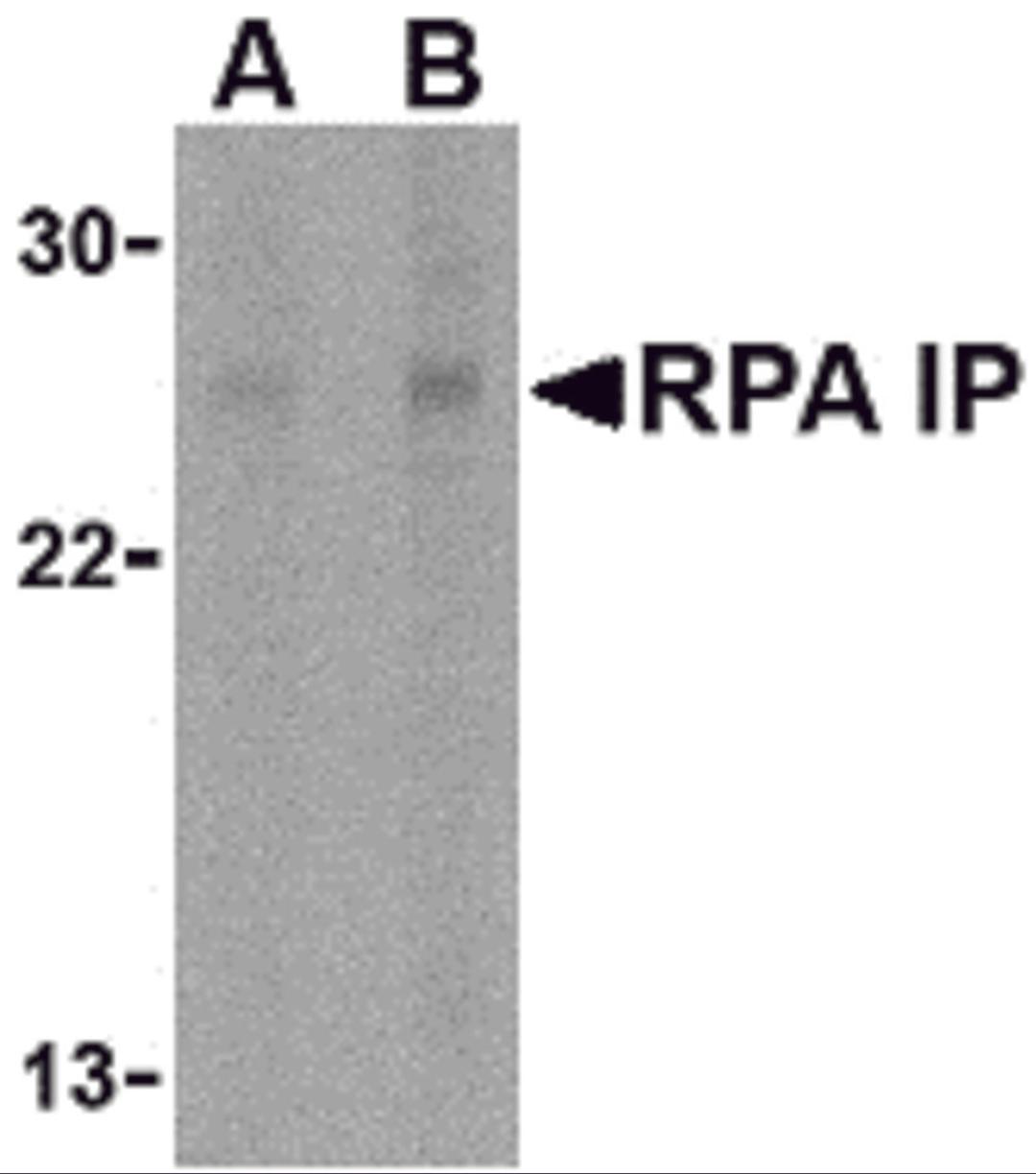 Western blot analysis of RPA Interacting Protein in Jurkat cell lysate with RPA Interacting Protein antibody at (A) 1 and (B) 2 μg/mL.