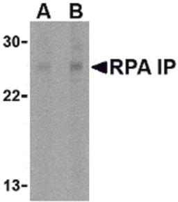 Western blot analysis of RPA Interacting Protein in Jurkat cell lysate with RPA Interacting Protein antibody at (A) 1 and (B) 2 μg/mL.