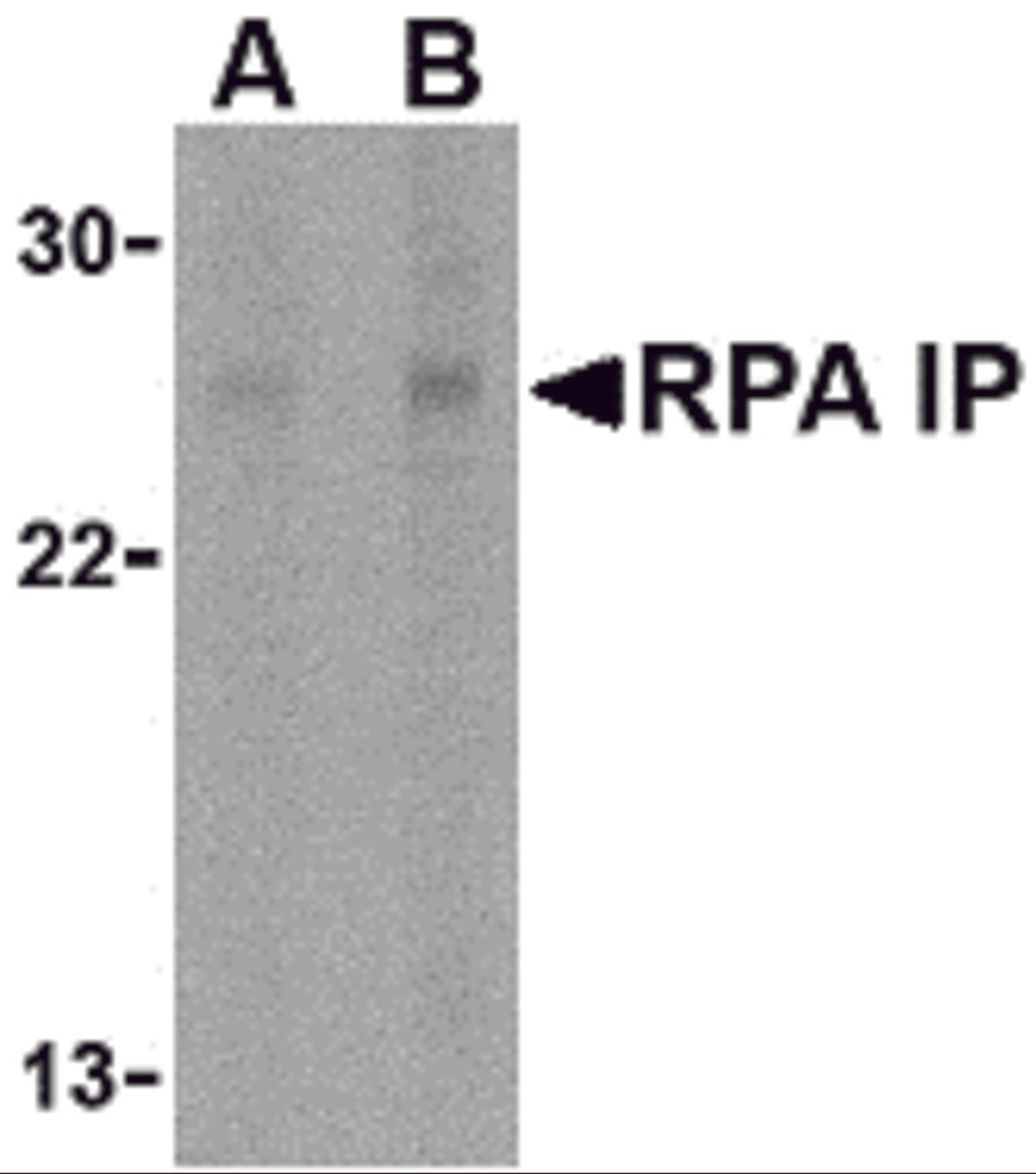 Western blot analysis of RPA Interacting Protein in Jurkat cell lysate with RPA Interacting Protein antibody at (A) 1 and (B) 2 μg/mL.