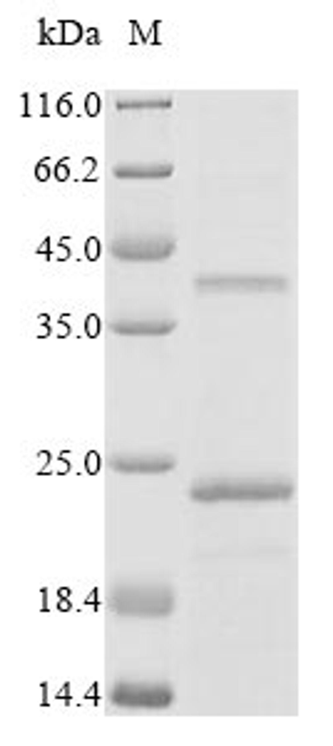 (Tris-Glycine gel) Discontinuous SDS-PAGE (reduced) with 5% enrichment gel and 15% separation gel.