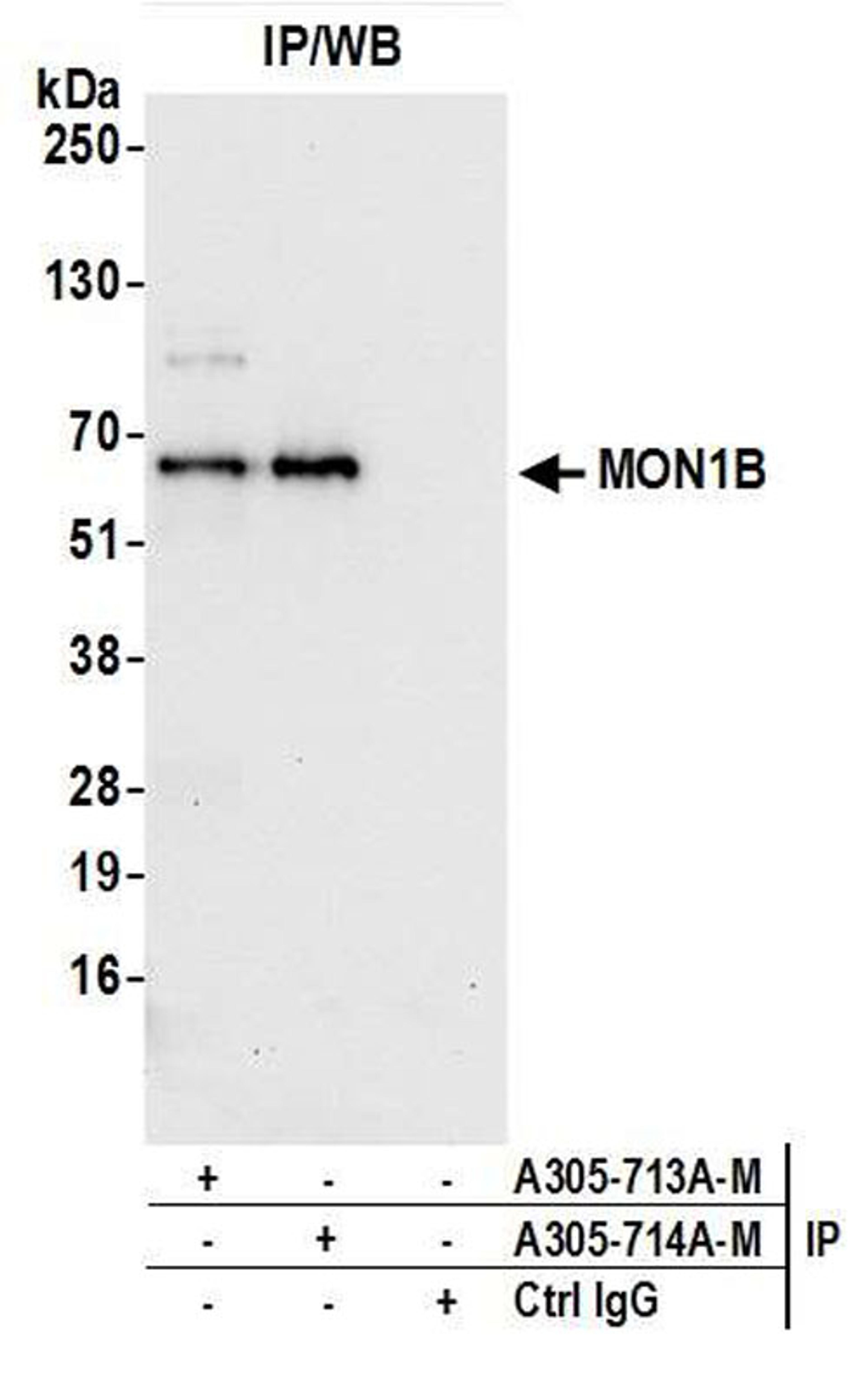 Detection of human MON1B by WB of IP.