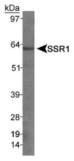 Western Blot: Somatostatin Receptor 1 Antibody [NB300-120] - Detection of SSR1 from rat pancreas using NB300-120 (1:1000).