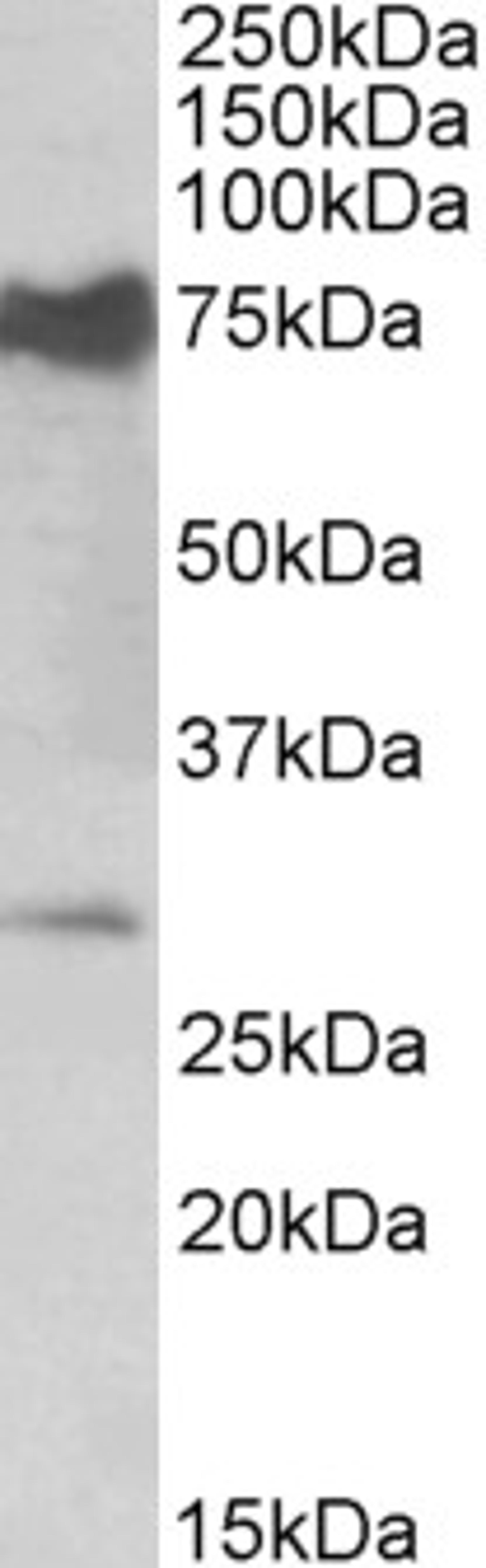 42-336 (0.5ug/ml) staining of Mouse Heart lysate (35ug protein in RIPA buffer). Primary incubation was 1 hour. Detected by chemiluminescence.