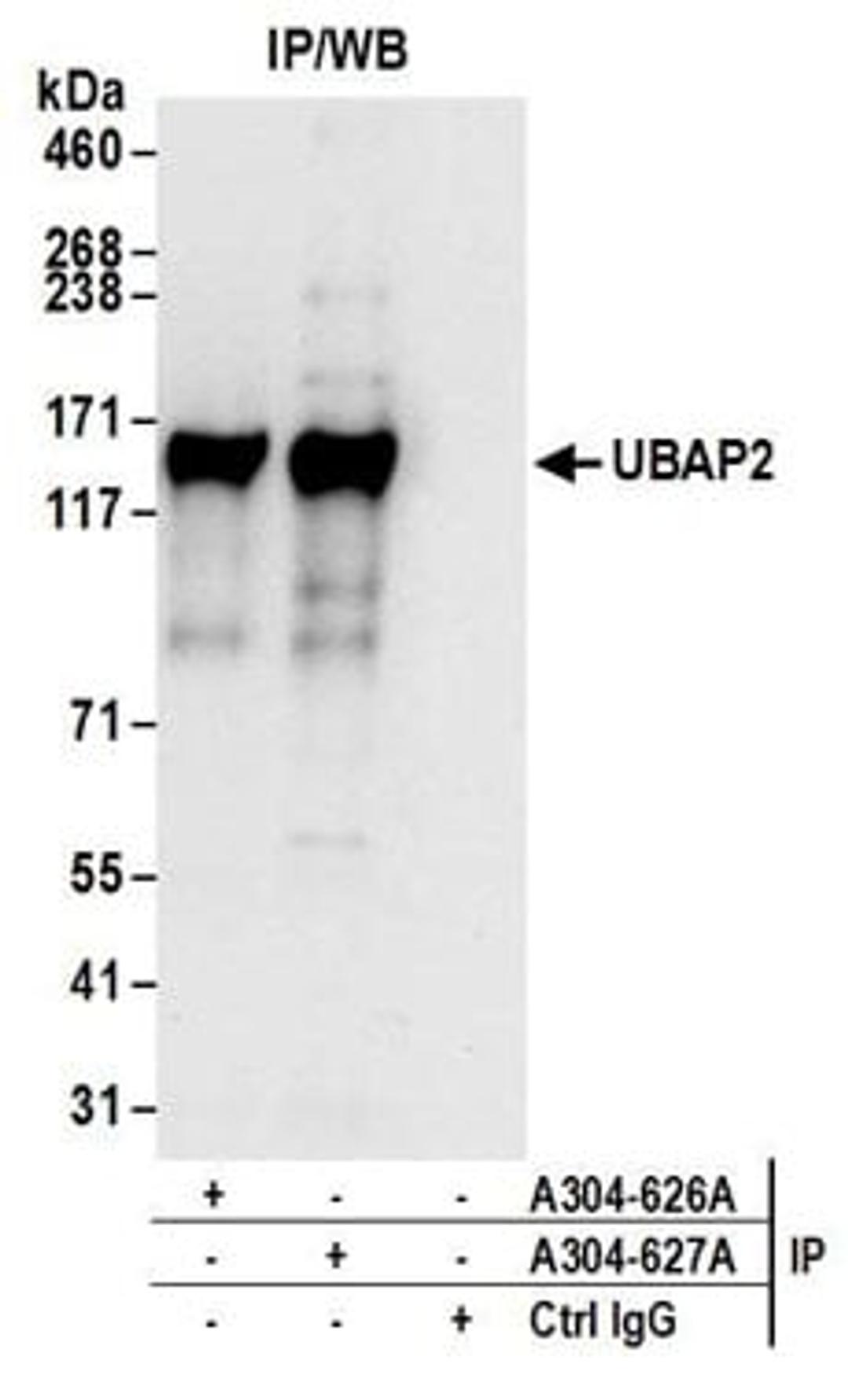 Detection of human UBAP2 by western blot of immunoprecipitates.