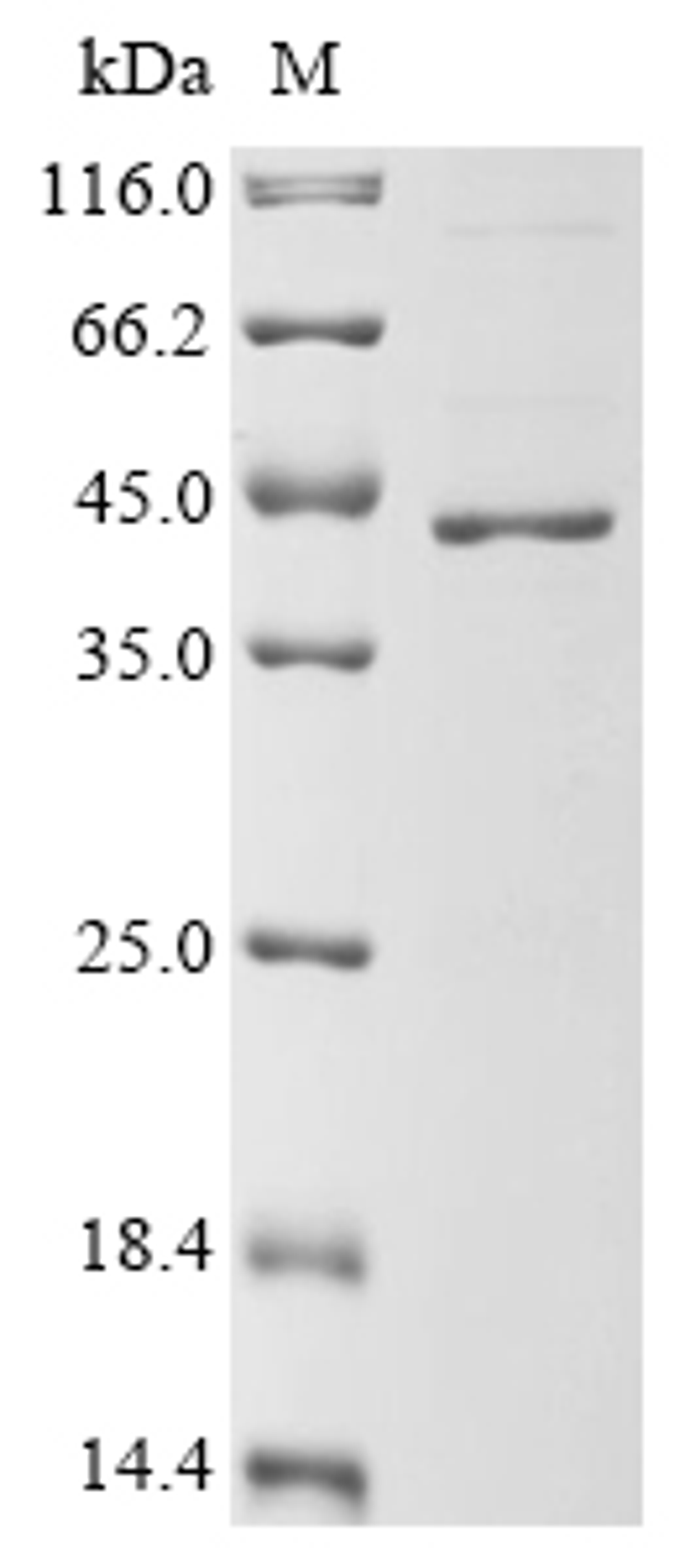 (Tris-Glycine gel) Discontinuous SDS-PAGE (reduced) with 5% enrichment gel and 15% separation gel.
