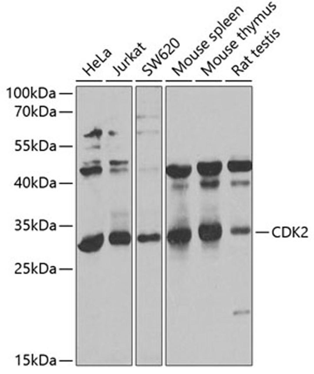 Western blot - CDK2 antibody (A0294)