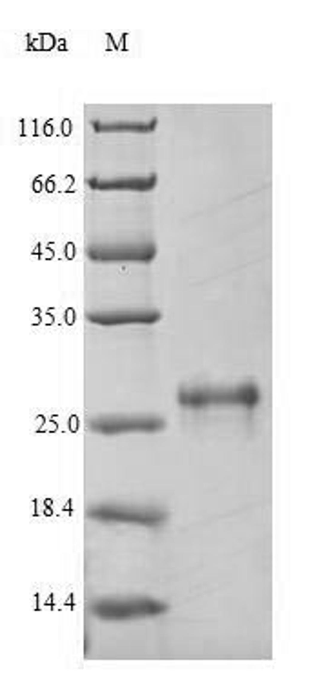 (Tris-Glycine gel) Discontinuous SDS-PAGE (reduced) with 5% enrichment gel and 15% separation gel.