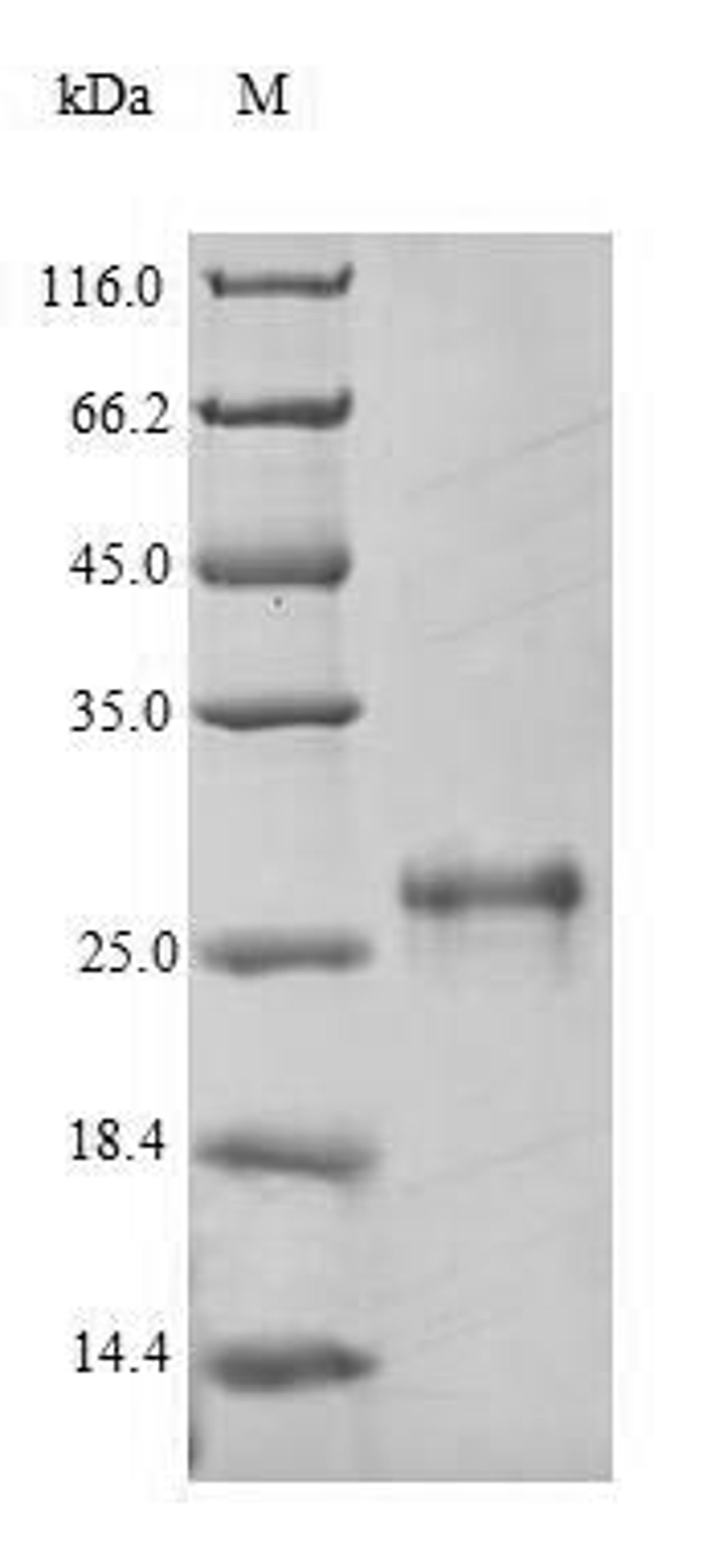 (Tris-Glycine gel) Discontinuous SDS-PAGE (reduced) with 5% enrichment gel and 15% separation gel.