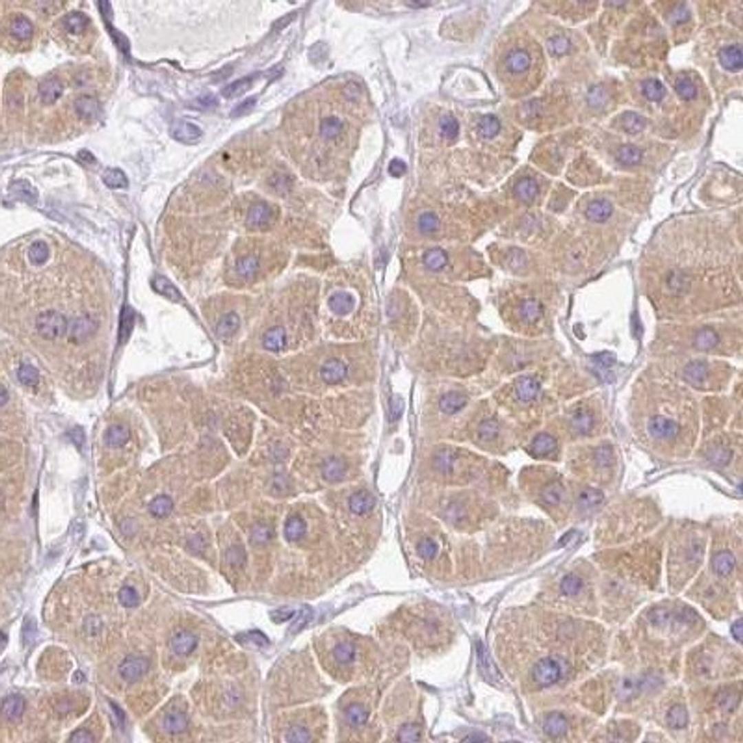 Immunohistochemistry: ADAMTS19 Antibody [NBP2-31627] - renal cancer